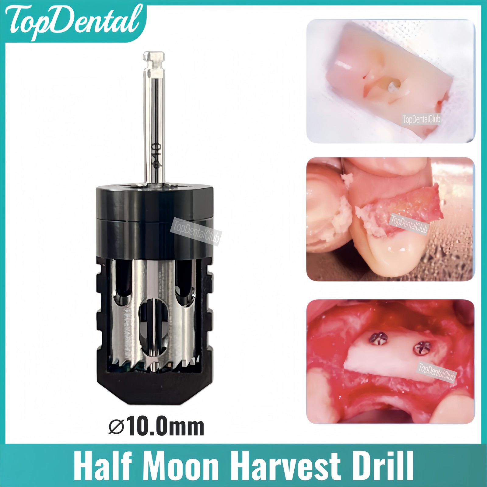 ⌀10.0mm Dental SLT Half Moon Harvest Drill Semilunar Technique Bone Augmentation