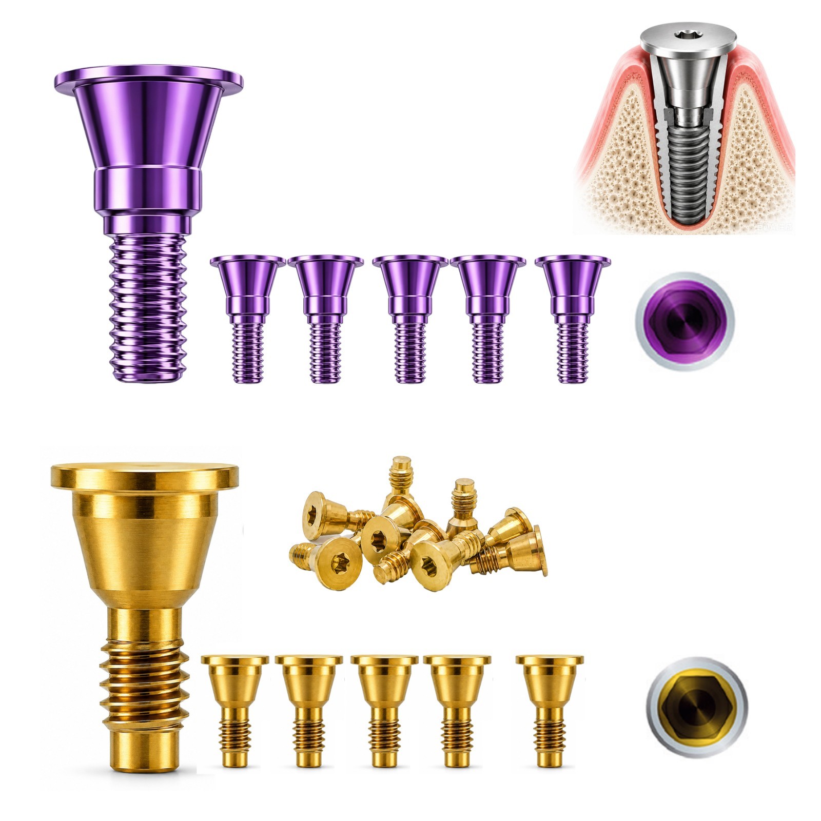 Multiple Implant Healing Abutment & Closure Cover Screw Hiossen Nobel Straumann