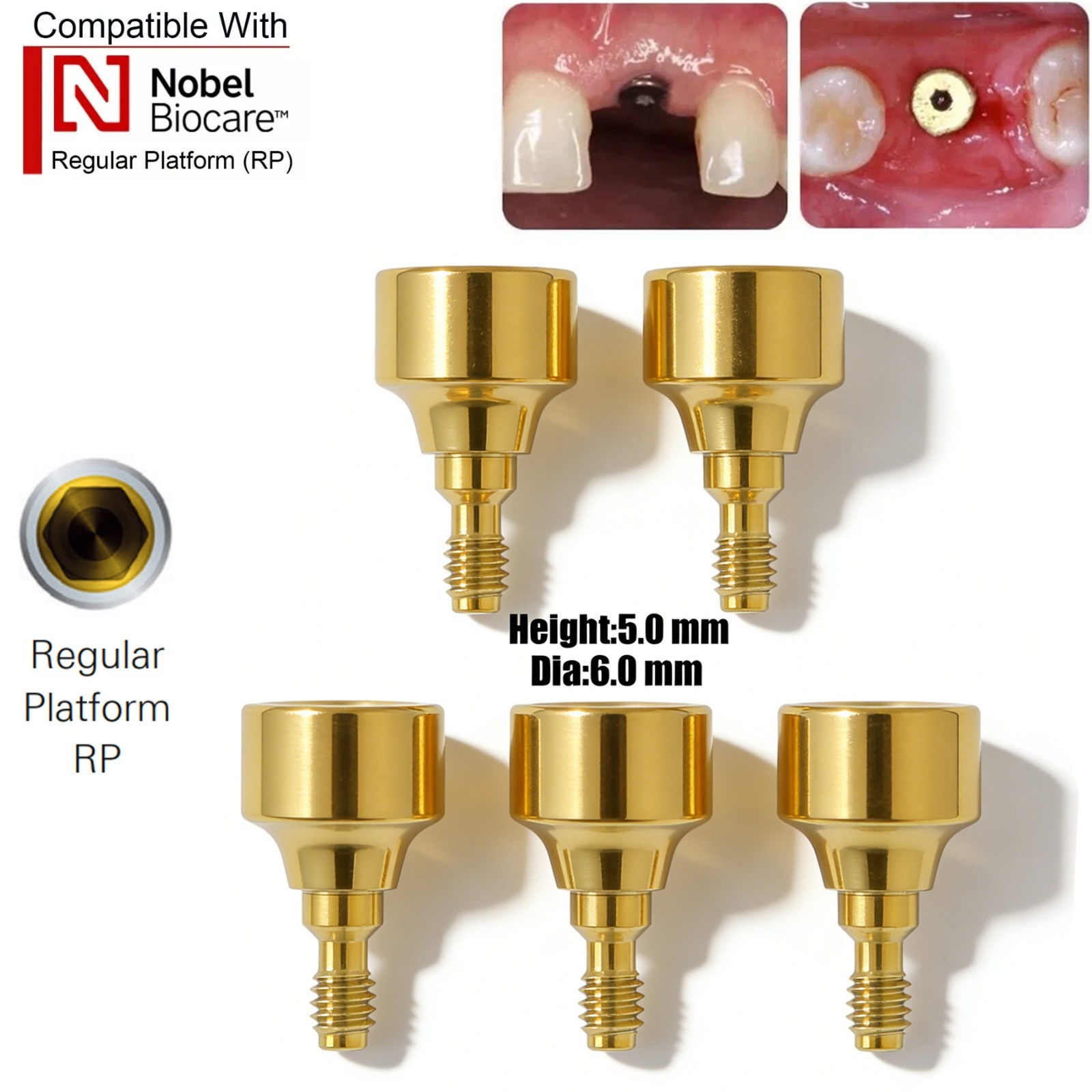 US 5Pcs Dental Healing Abutment NP/RP Internal Conical Fit Nobel Biocare Implant