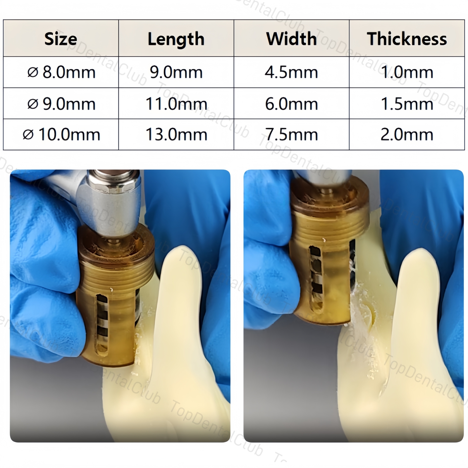 Dental SLT Half Moon Shaped Harvest Drill Semilunar Technique Collector Bone