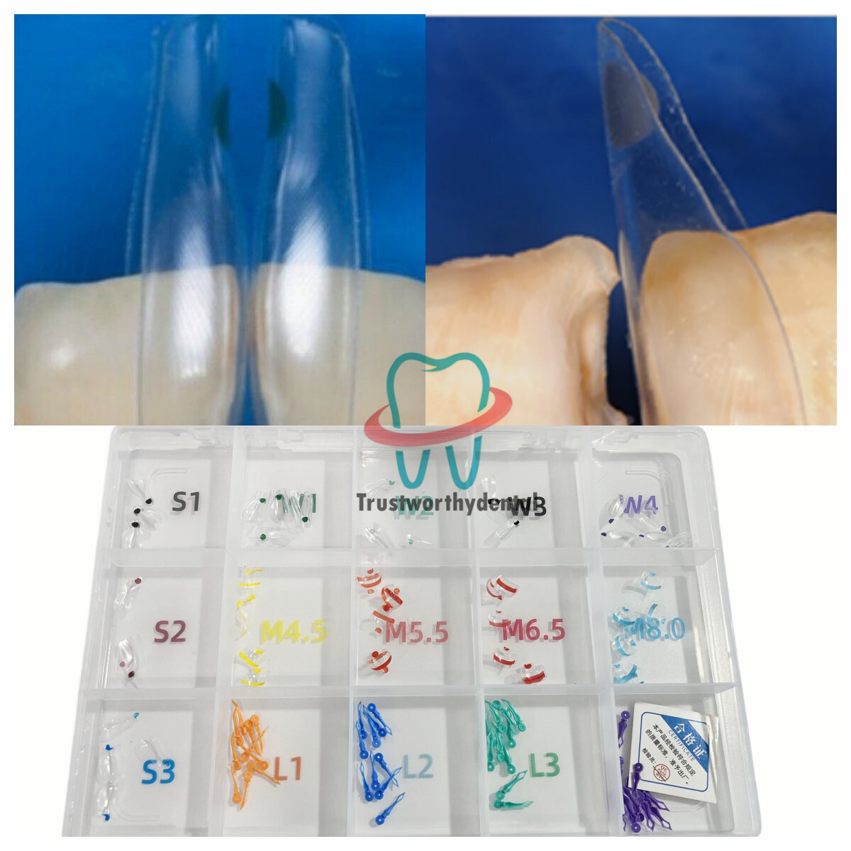 Dental Signet Anterior and Posterior Transparent Matrix Triall Molding Kit