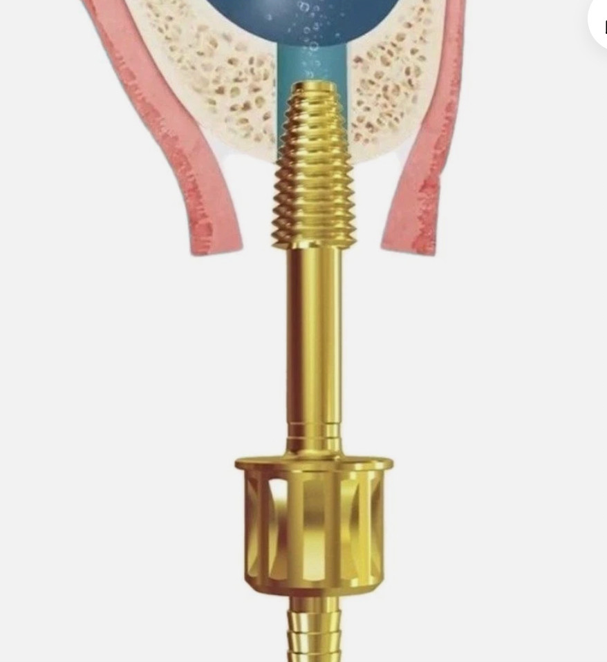 Maxillary Sinus Lift Water Rising Hydraulic Membrane Lifter Aqua Tip