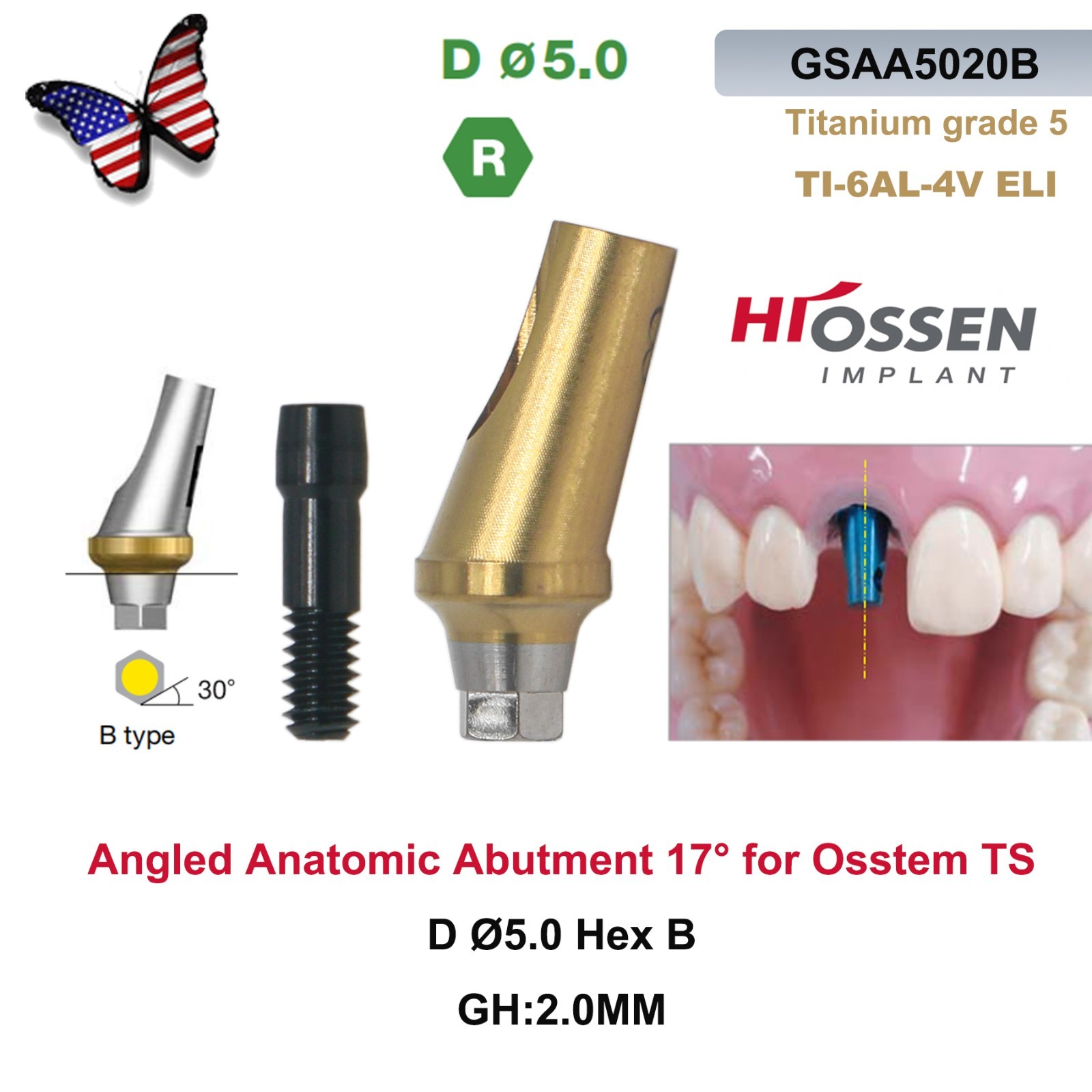 US Dental 17° Angled Abutment For Hiossen ET III Osstem TS Mini Regular Platform