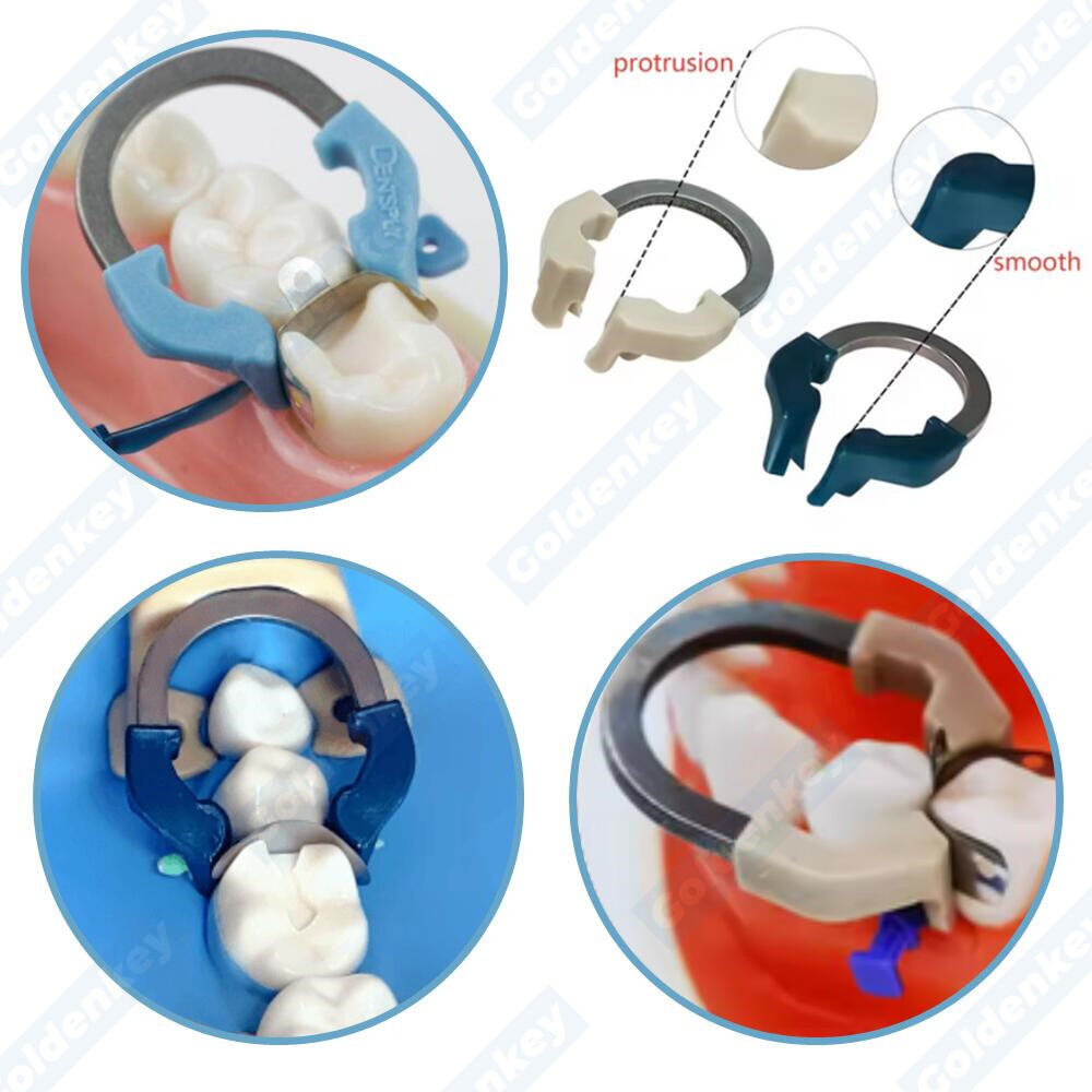 Dental Matrix Bands Ring Sectional Matrice Clamp Retaining Ring Fits Palodent V3