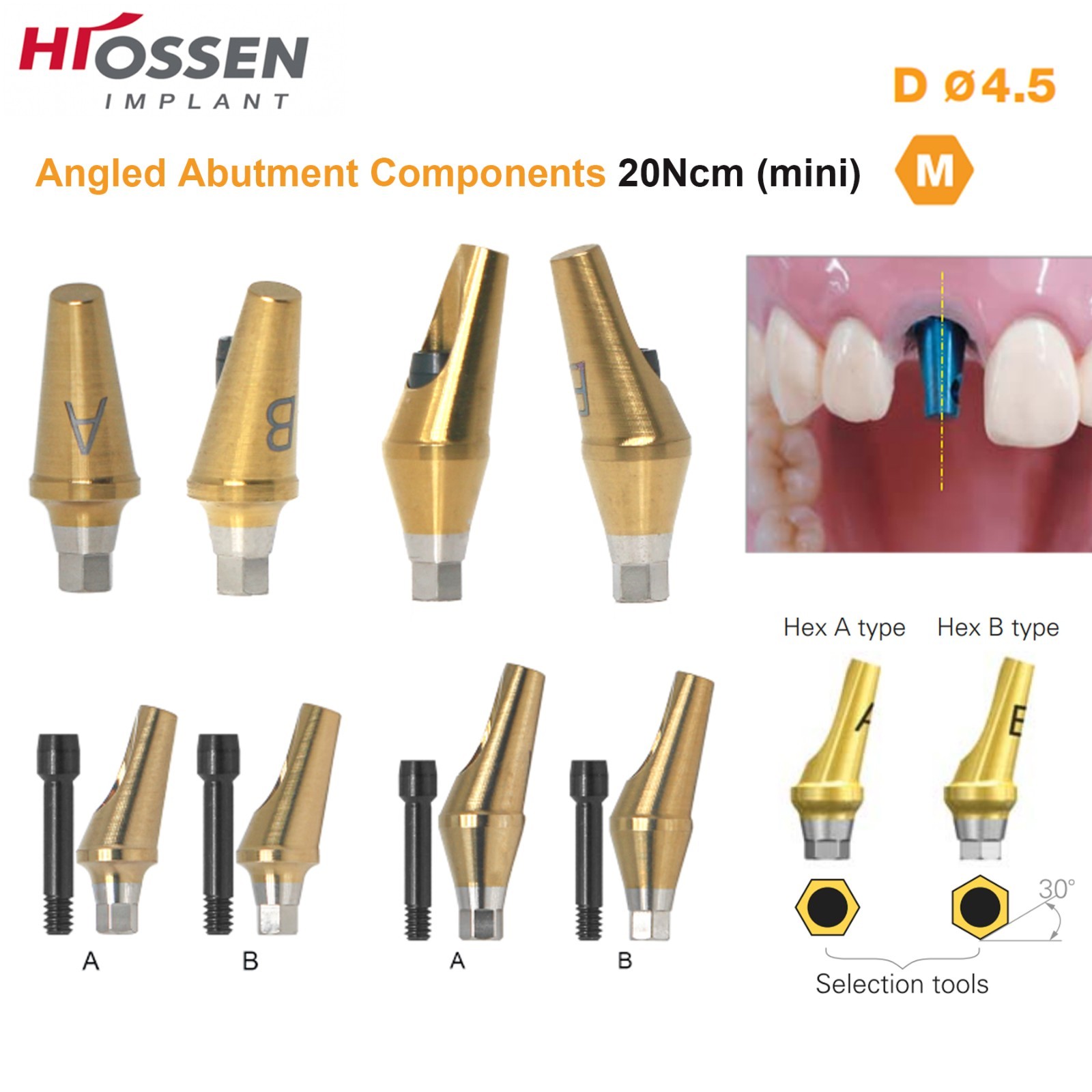 US Dental 17° Angled Abutment For Hiossen ET III Osstem TS Mini Regular Platform