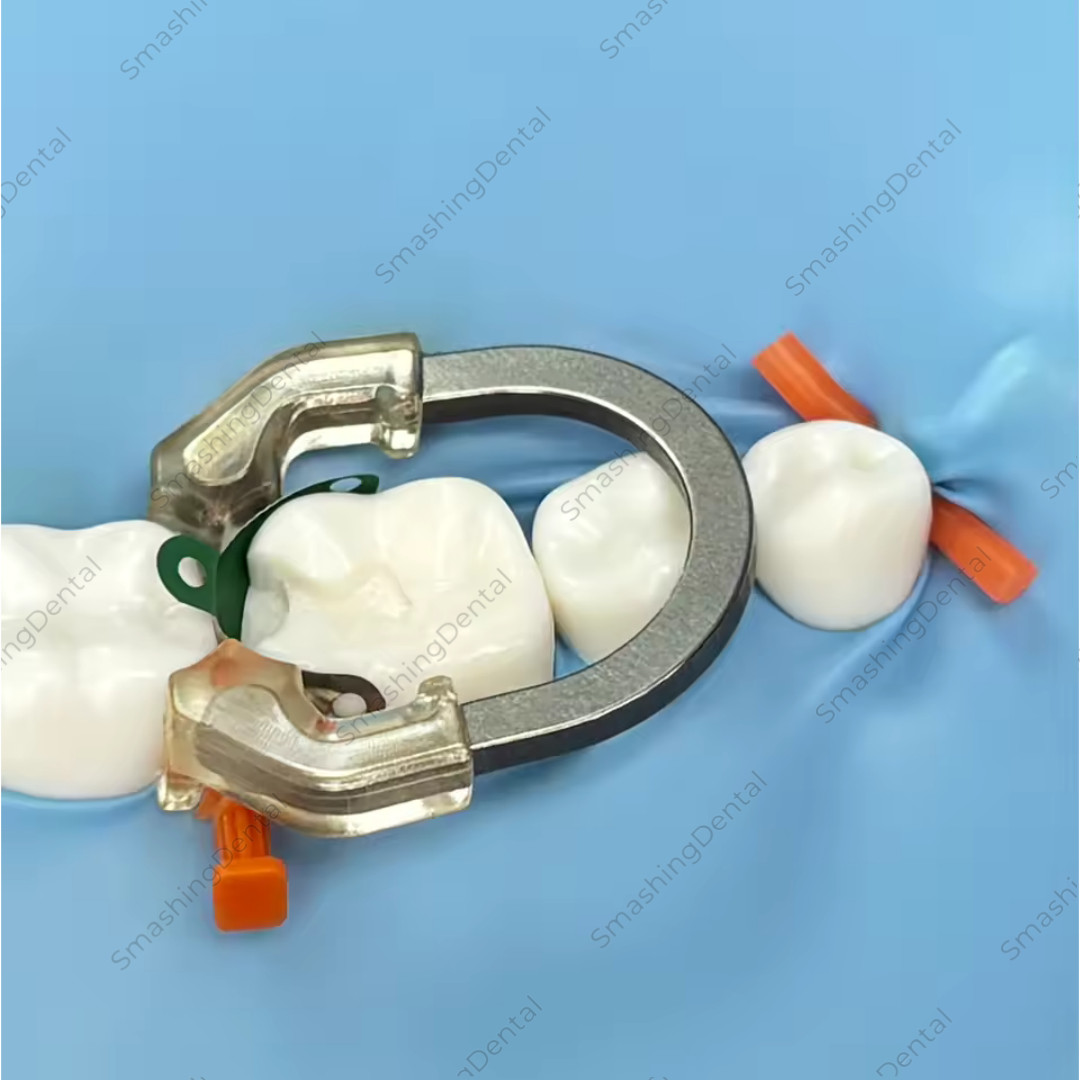 Dental NITI Transparent Matrix Clip Ring Sectional Matrix Clamp Elastic Clear US
