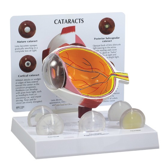 Eye Cataract Cornea Eye Set of 3 GPI Anatomy Models #4021 Make Offer! SEE VIDEO