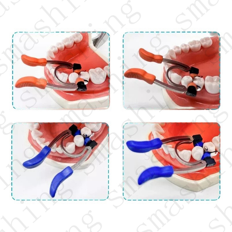 Dental Matrix Bands Ring Sectional Matrice Clamp Fit Palodent V3 System