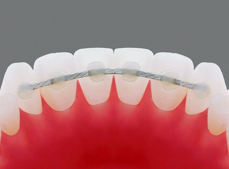 Dental Lingual Retainer Twist Wire Flat Stainless Twisted Wires Ortho Brackets