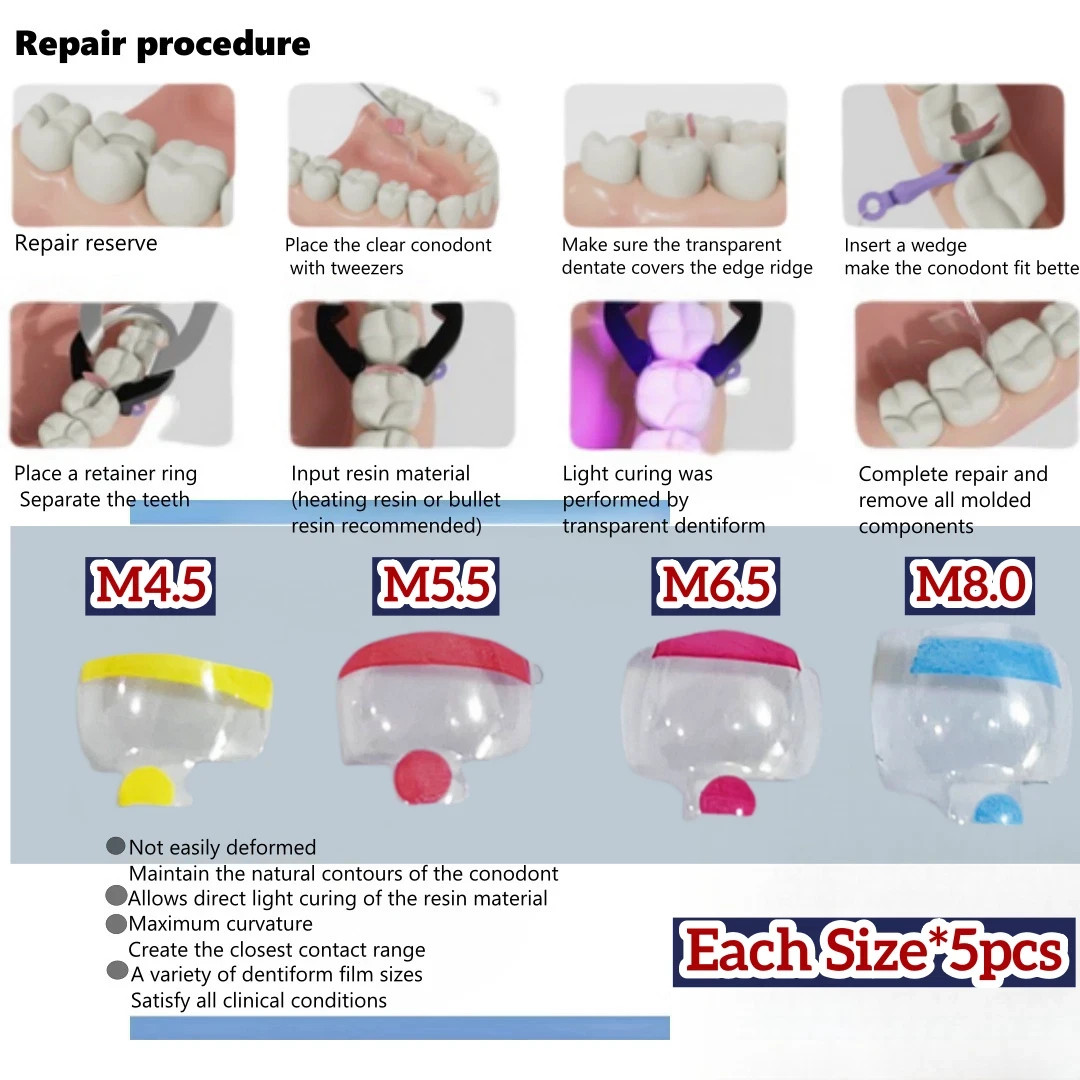 Dental Transparent BT Matrices Clear Matrix Anterior Posterior Fit BioClear