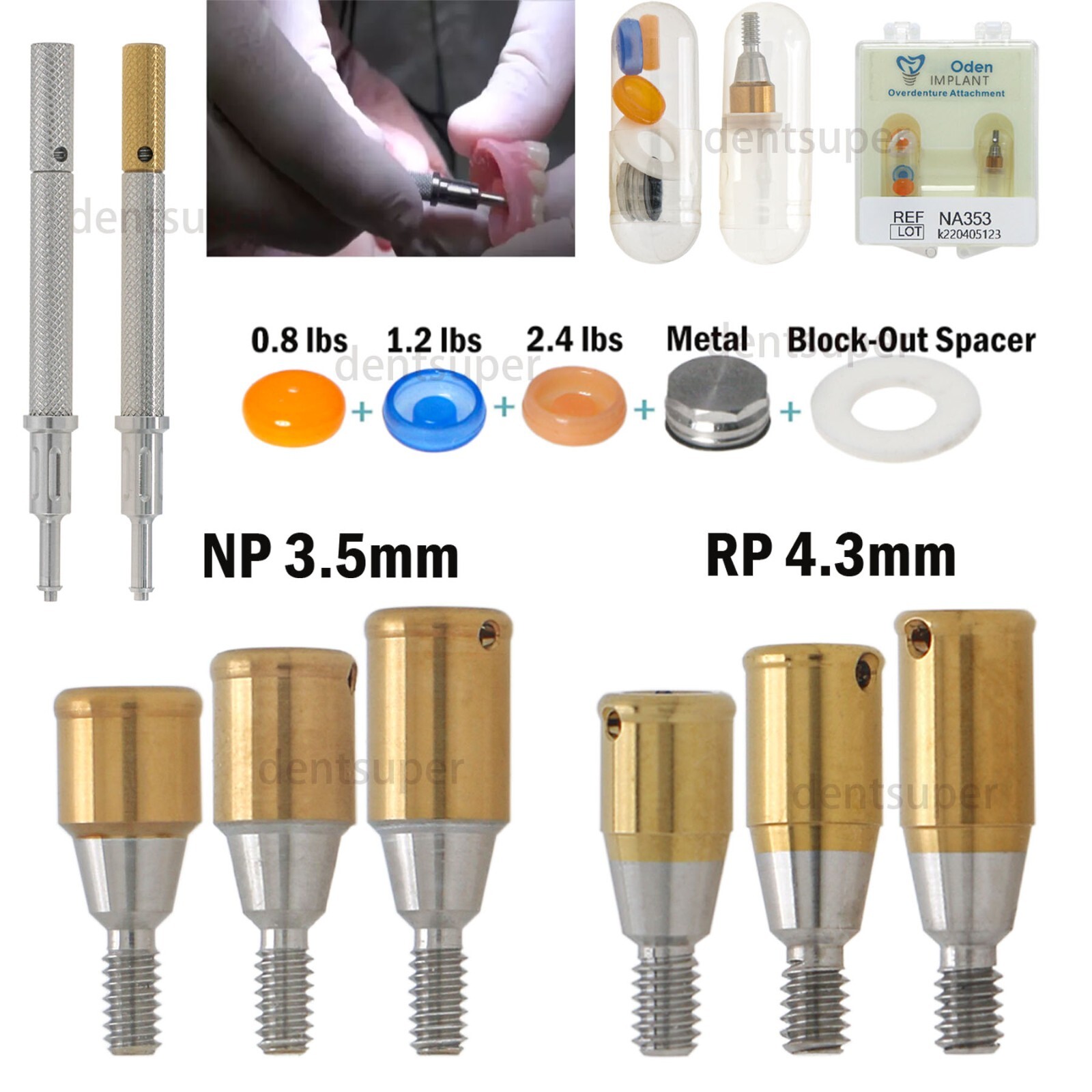 Dental Removable NP/RP Conical Attachment Male Cap Core Tool for Nobel Implants