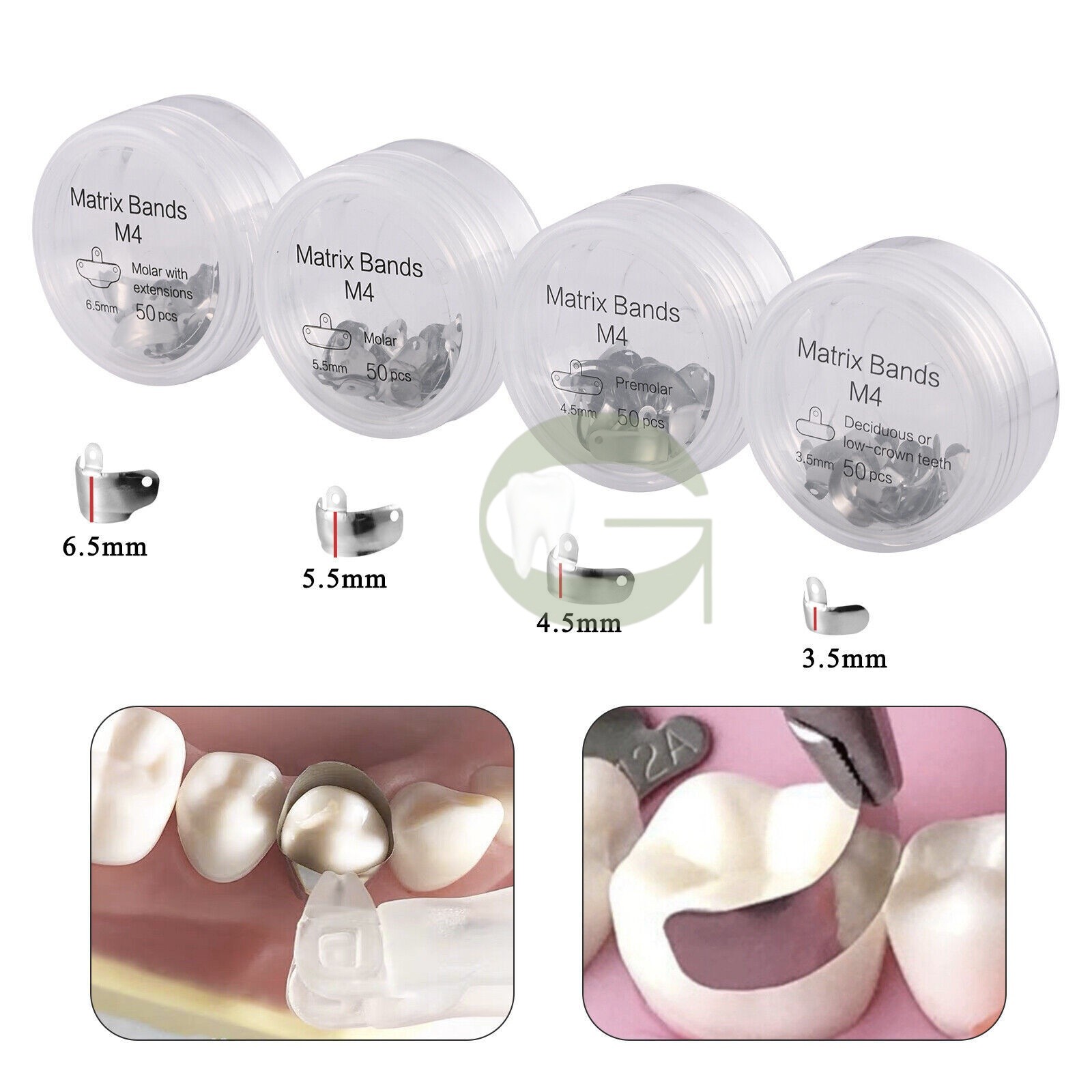 Dental Matrix Bands Ring Sectional Matrice Clamp Titanium Alloy Ring NiTi Peek