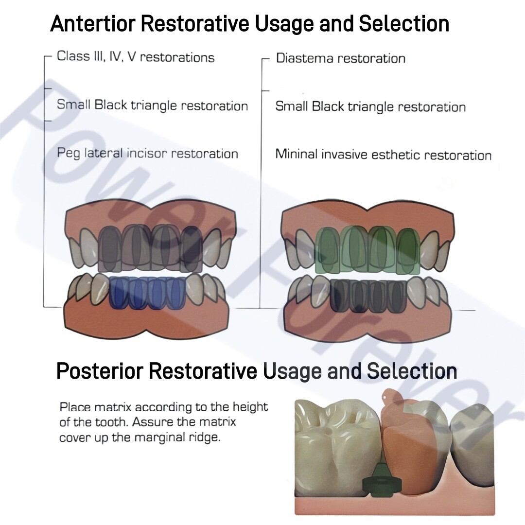 Dental Clear Matrix Diastema BT Matrices Wedges Similar with BioClear Matrice