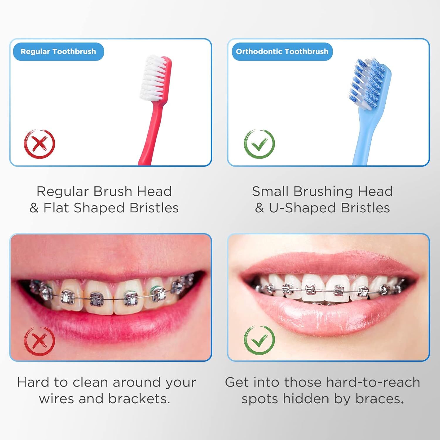 V-Shaped Orthodontic Toothbrush for Braces, Soft Bristles, 6 Count, with…