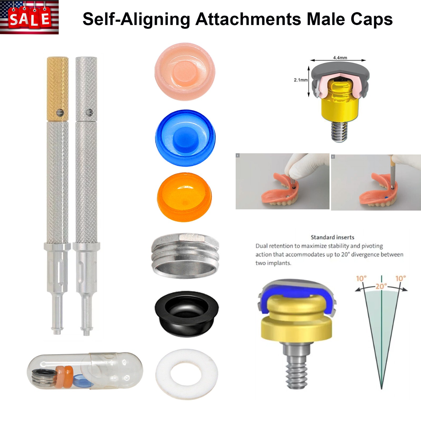 Locator Abutment System Overdenture Kit Compatible with Hiossen / Osstem Implant