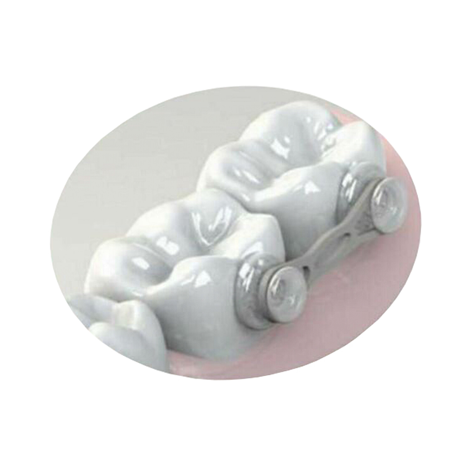 20 Dental Orthodontic Transparent Composite Lingual Anchor Buttons Aesthetic