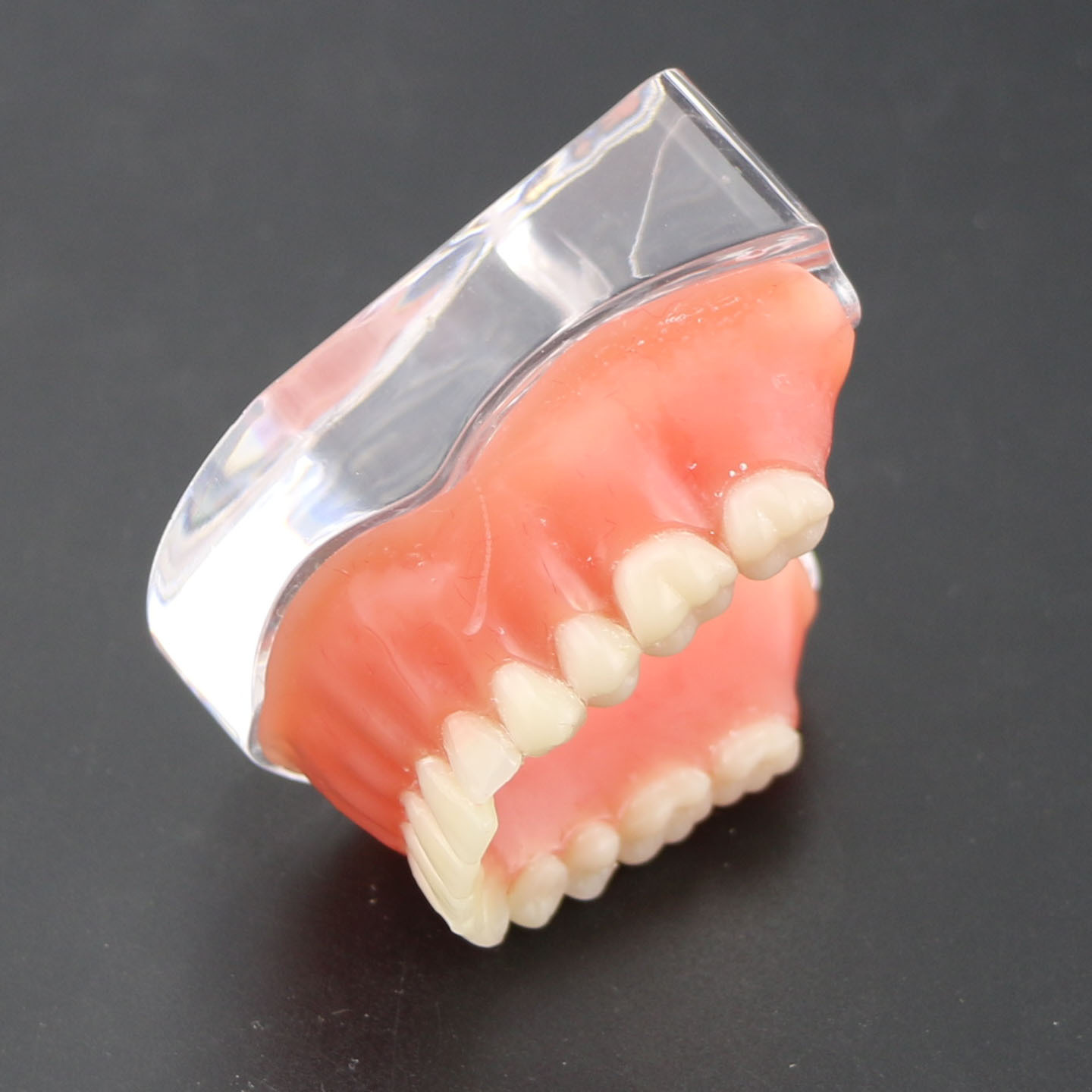 Dental Teeth Implant Model Inferior Overdenture 4 Implants Denture Demo Training