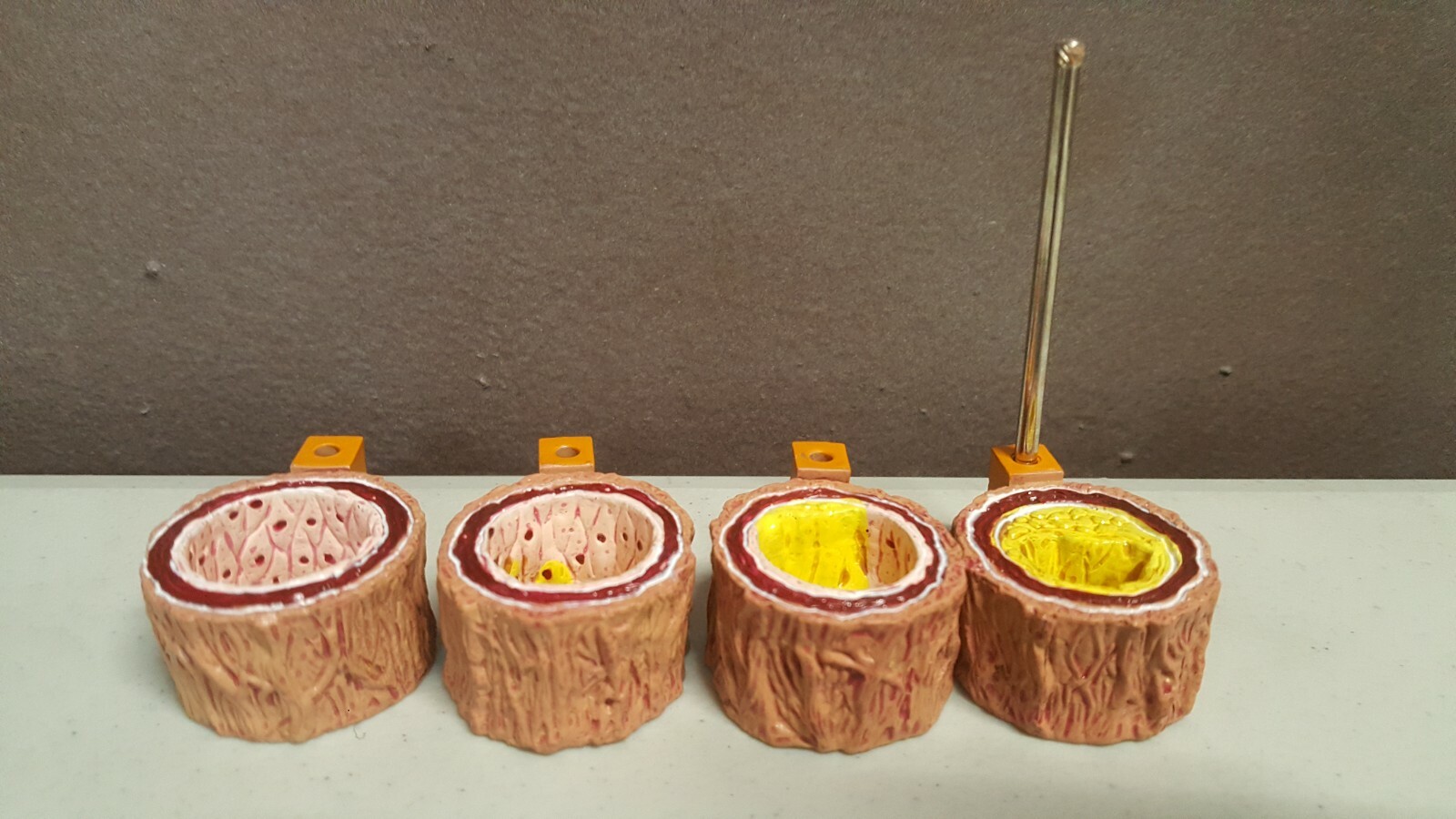 GPI 4-Piece Artery 1 part – Model #2650