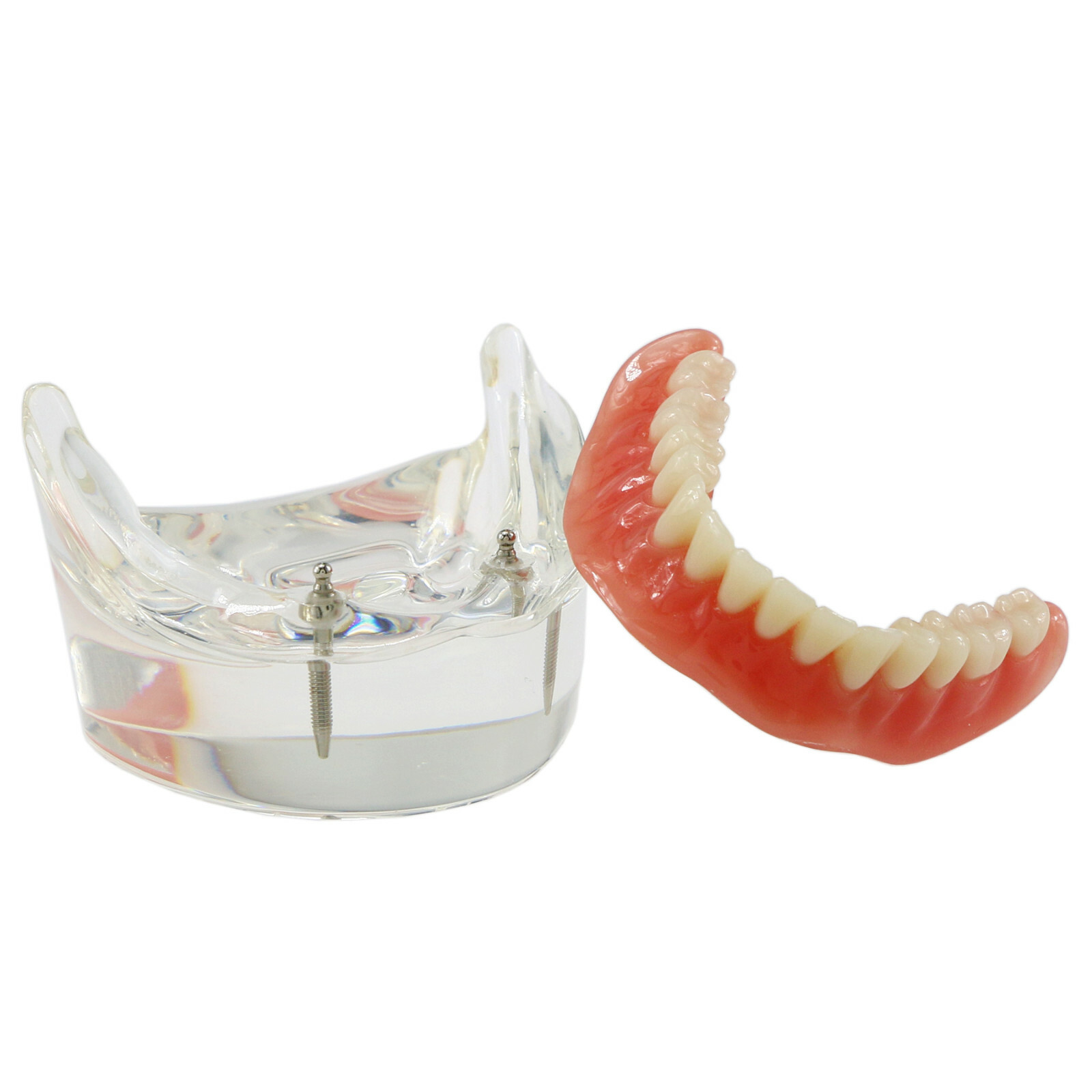 Dental Typodont Teeth Model Overdenture Lower Inferior 2 Implants Demo M-6002 US