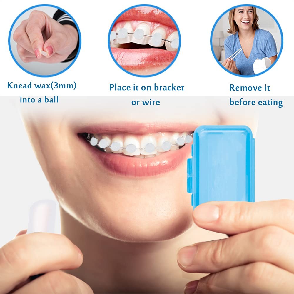 Braces Wax for Teeth 6 Pack Dental Care 6 Count (Pack of 1), Colorful