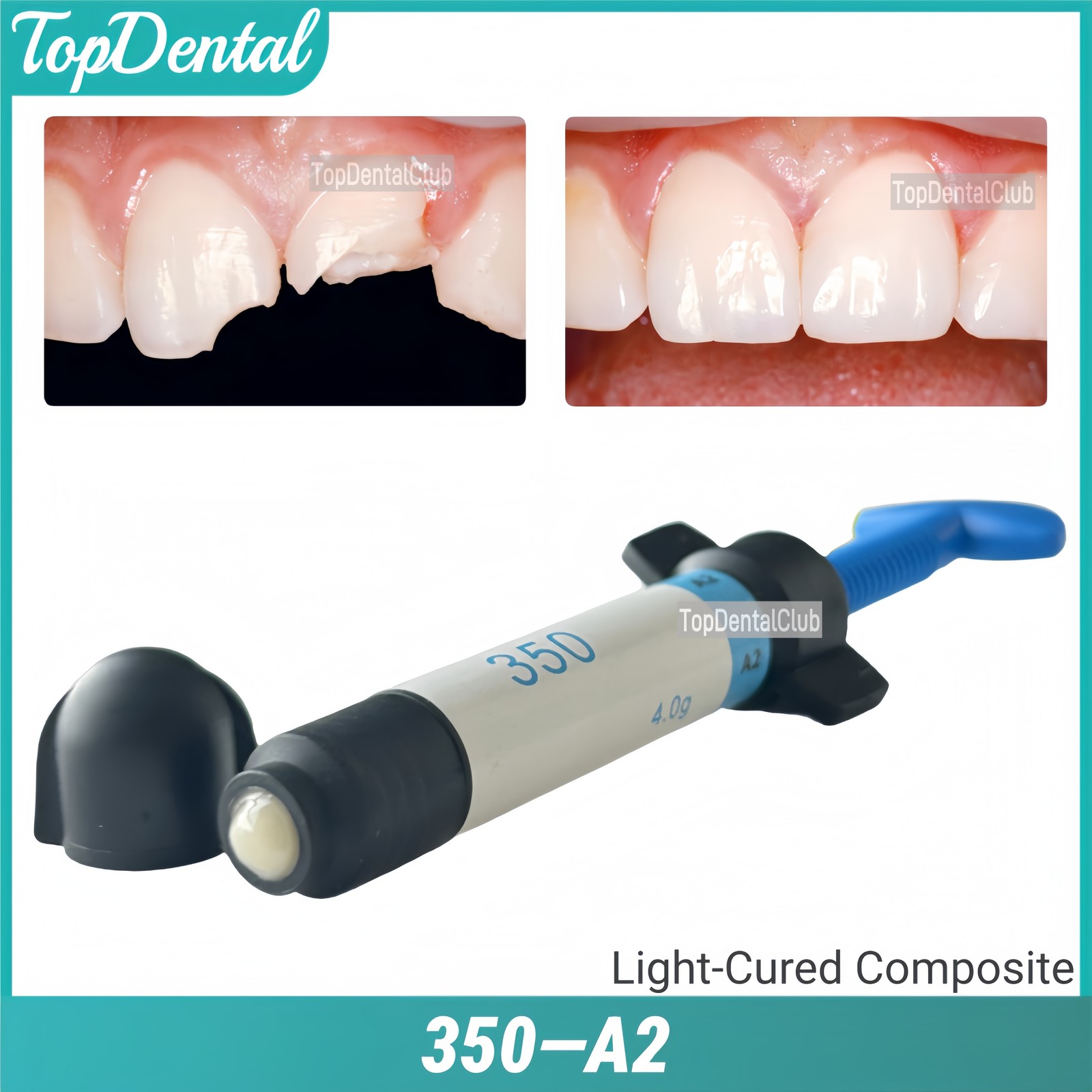 Z350 A2 Dental Light Cure Composite Resin Capsules Veneer Whitening Restoration