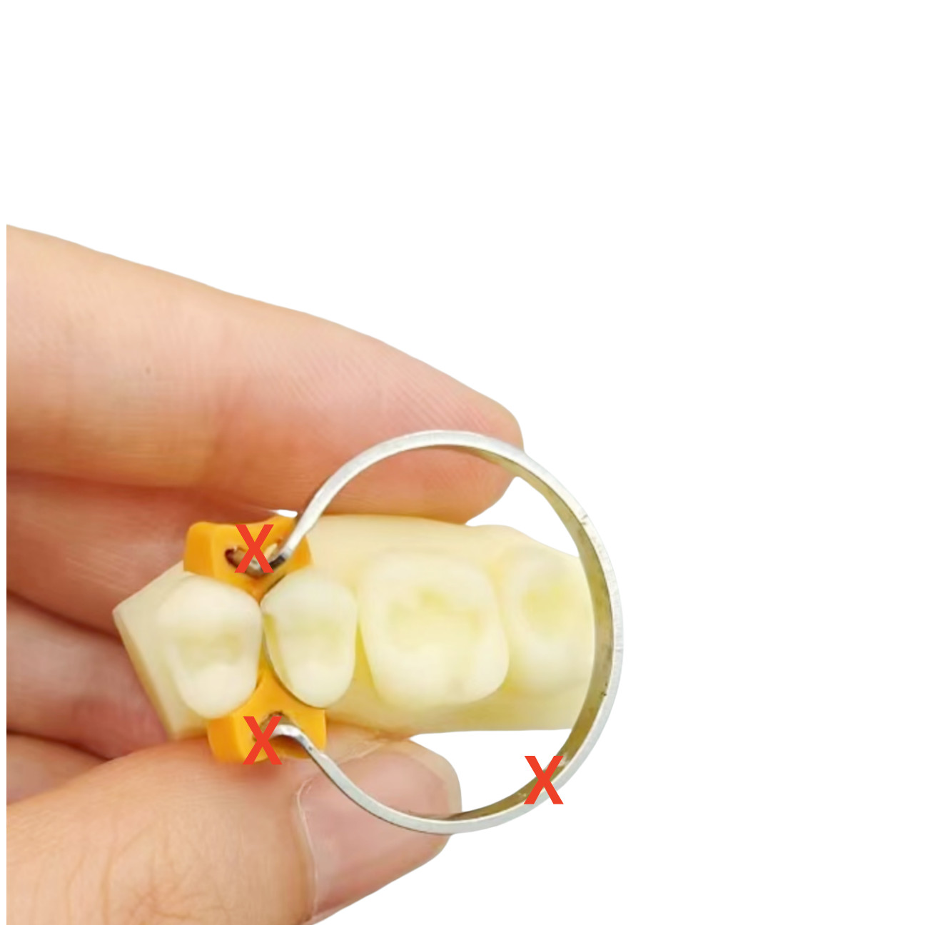 3Pieces Dental Healing Cap Abutment NP 3.6 H3 H5 H7 Compatible Nobel Active ∅3.6