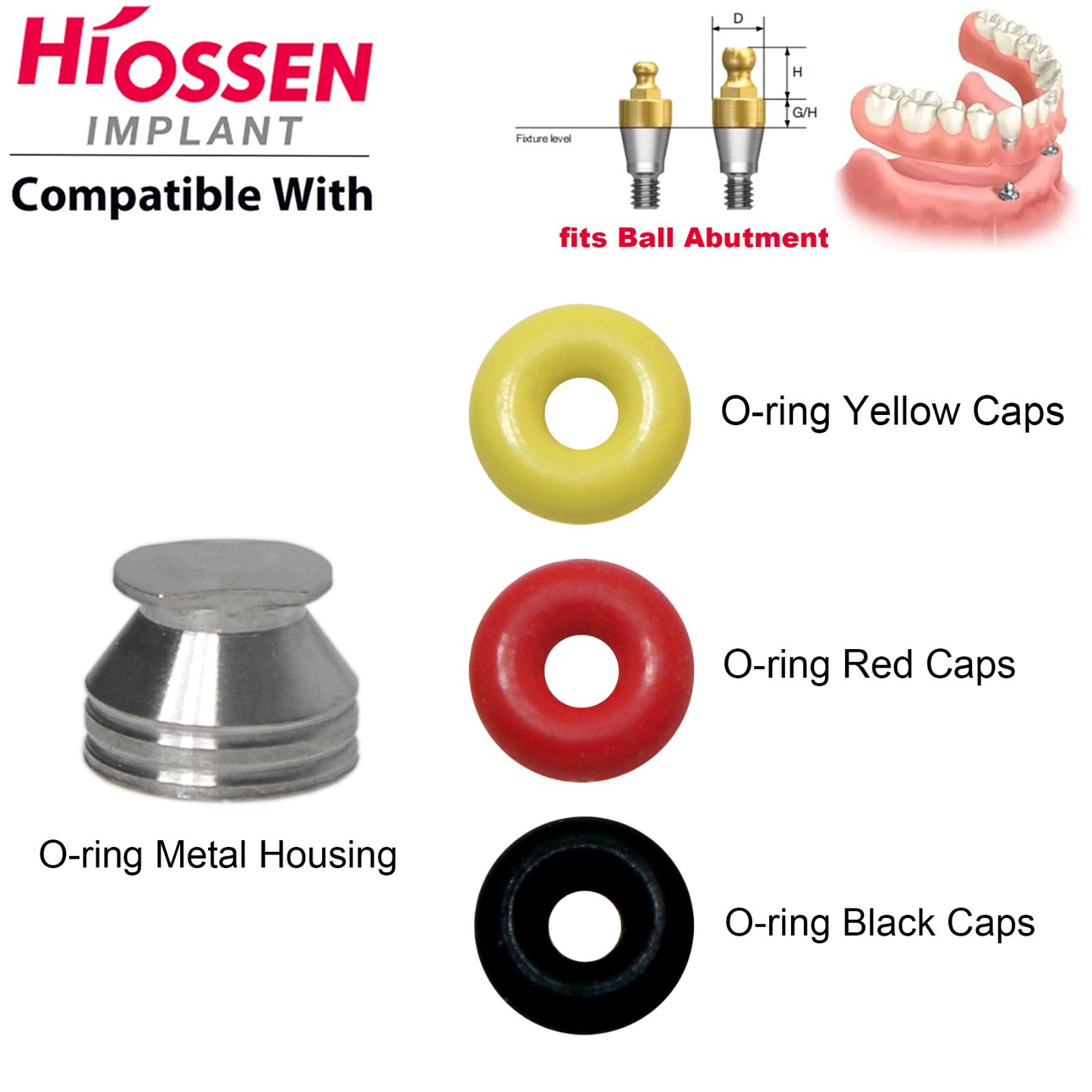 US Dental Implant O-Rings Retainer Caps Kit For Hiossen Osstem Ball Abutments