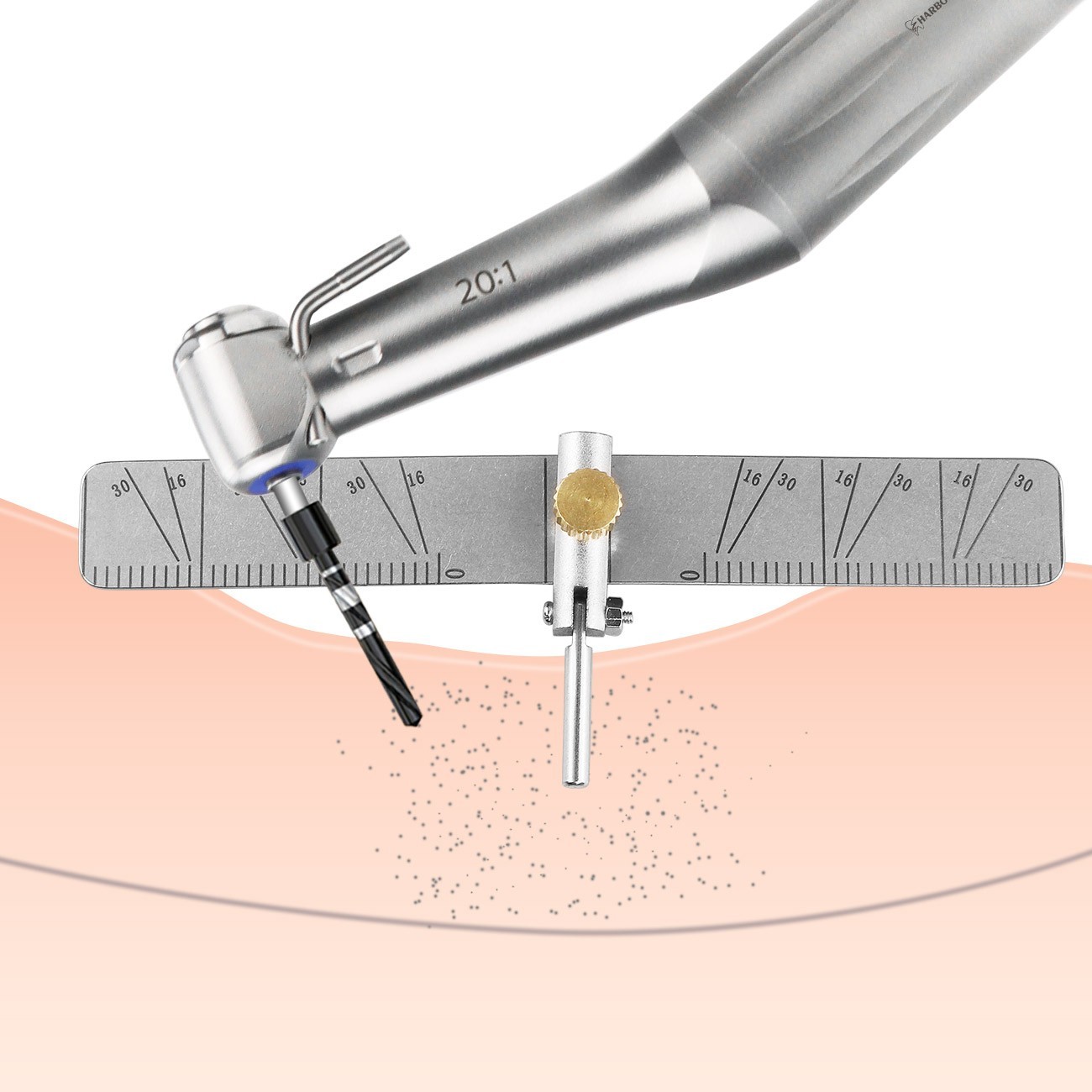 Dental Implant Locating Guide Surgical Planting Positioning Locator Ruler