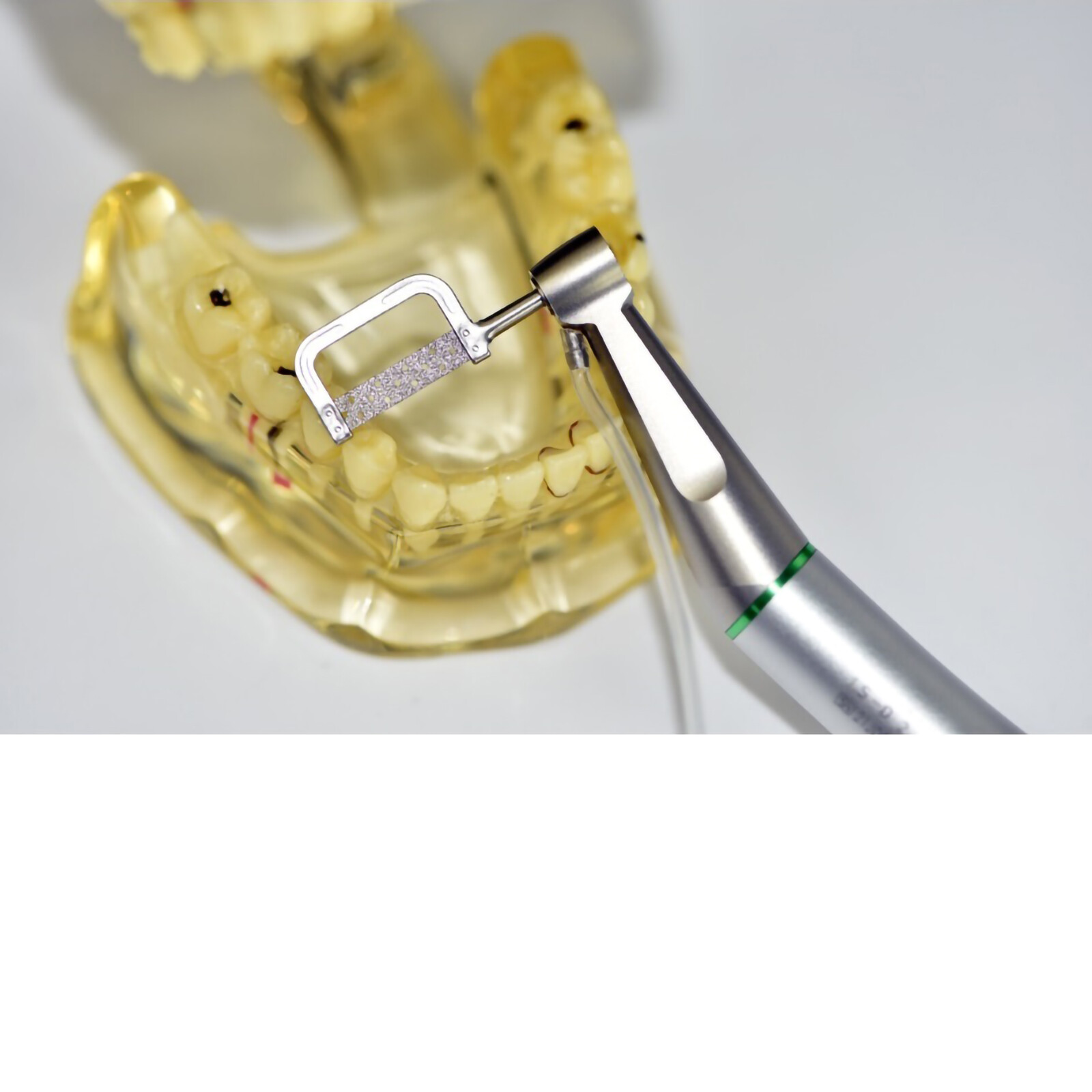 Dental Orthodontic IPR System Interproximal Enamel Reduction Set 4:1 for Eva Tip