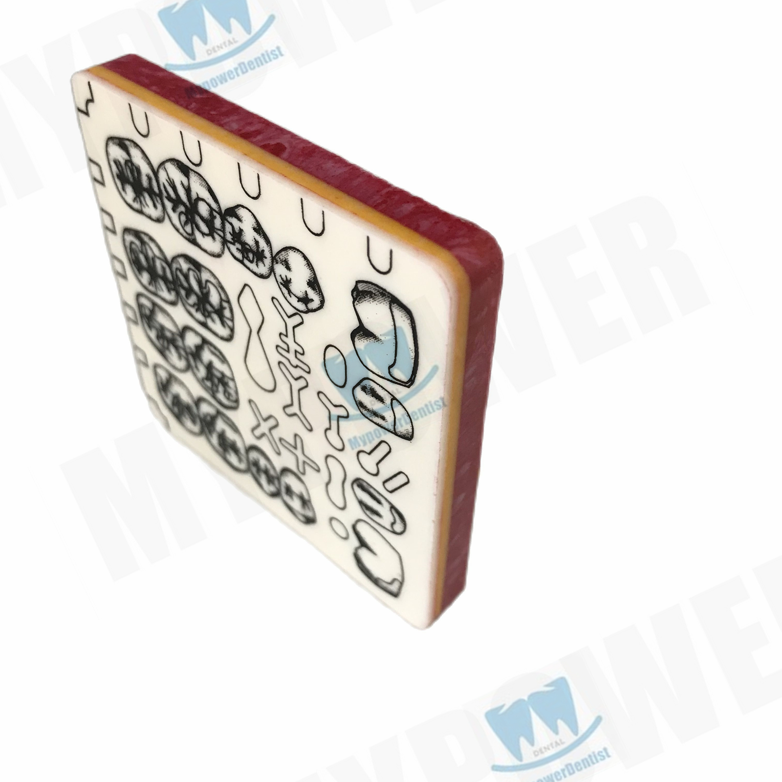Dental Cavity Preparation/Vitro Decay Caries Model/Composite Resin Filling Model