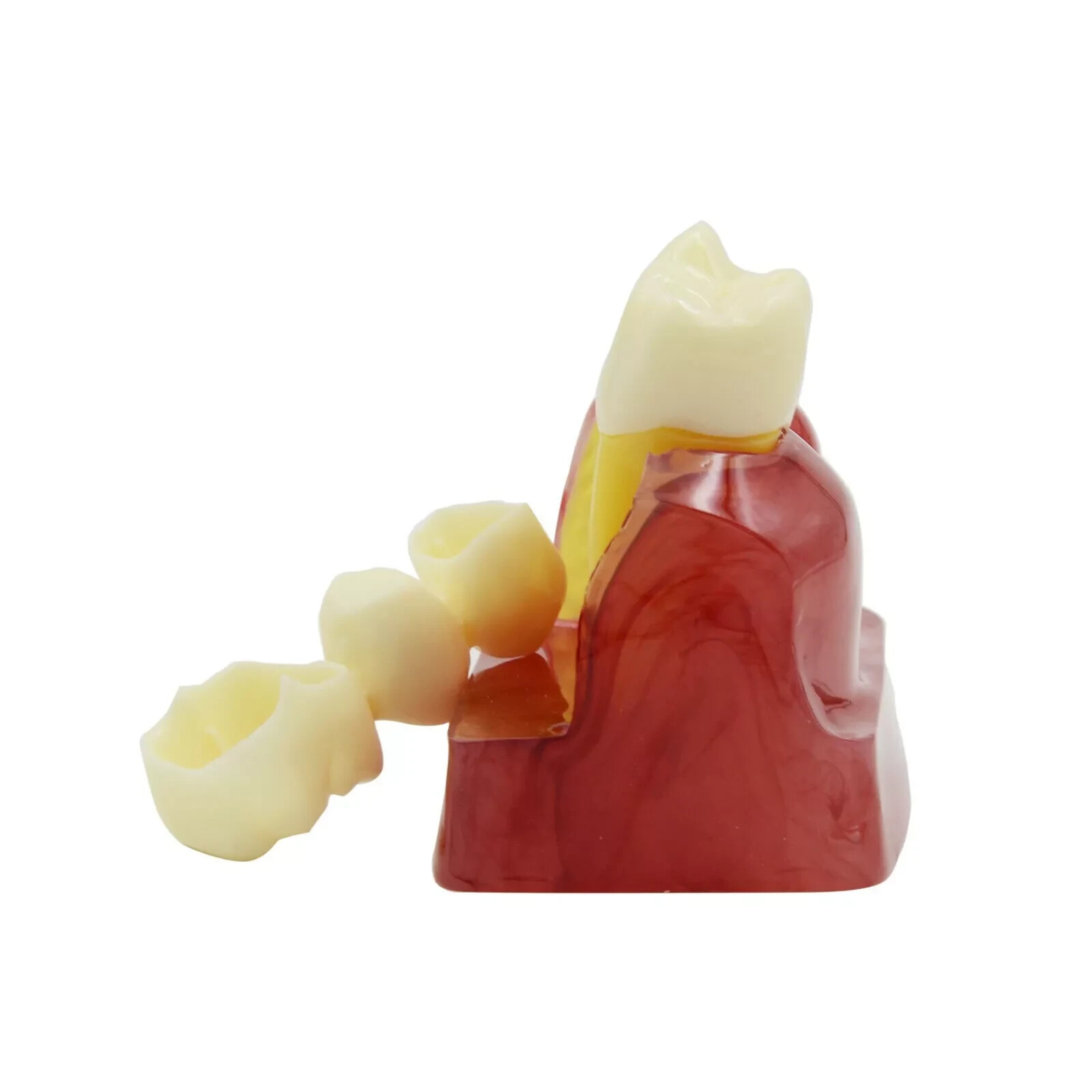 2Pc Dental Oral Analysis Crown Bridge Demonstration Tooth 4 Times Model Typodont