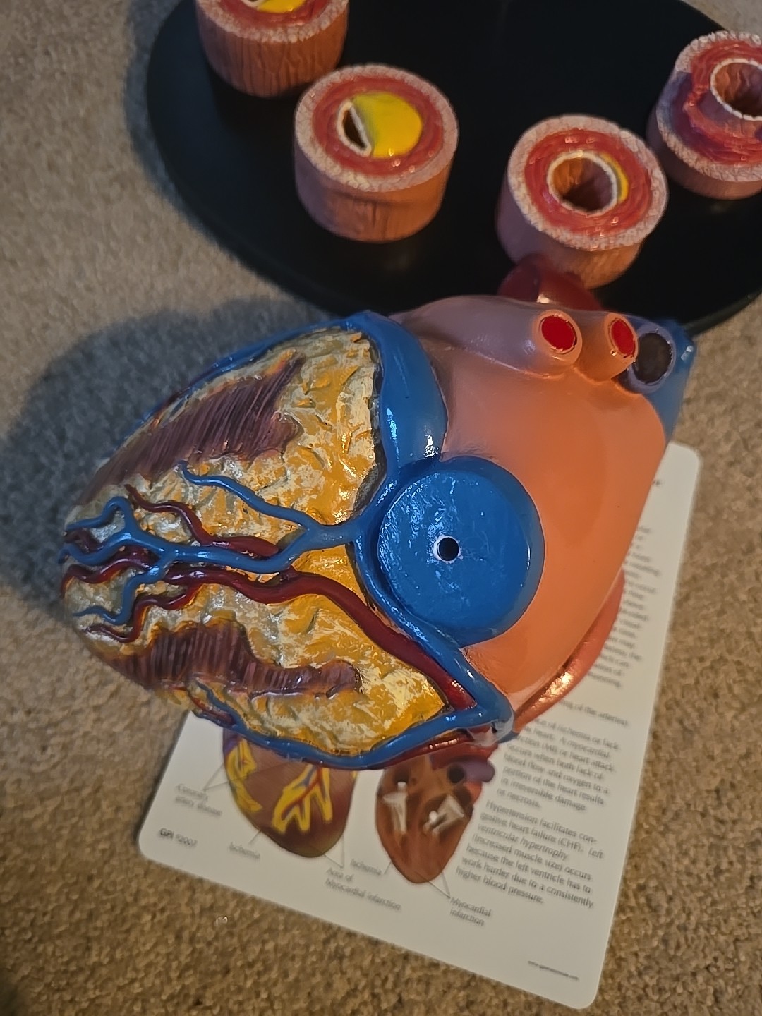 GPI Anatomical Heart Model, 2 Part – GP2500 With Card And Tray