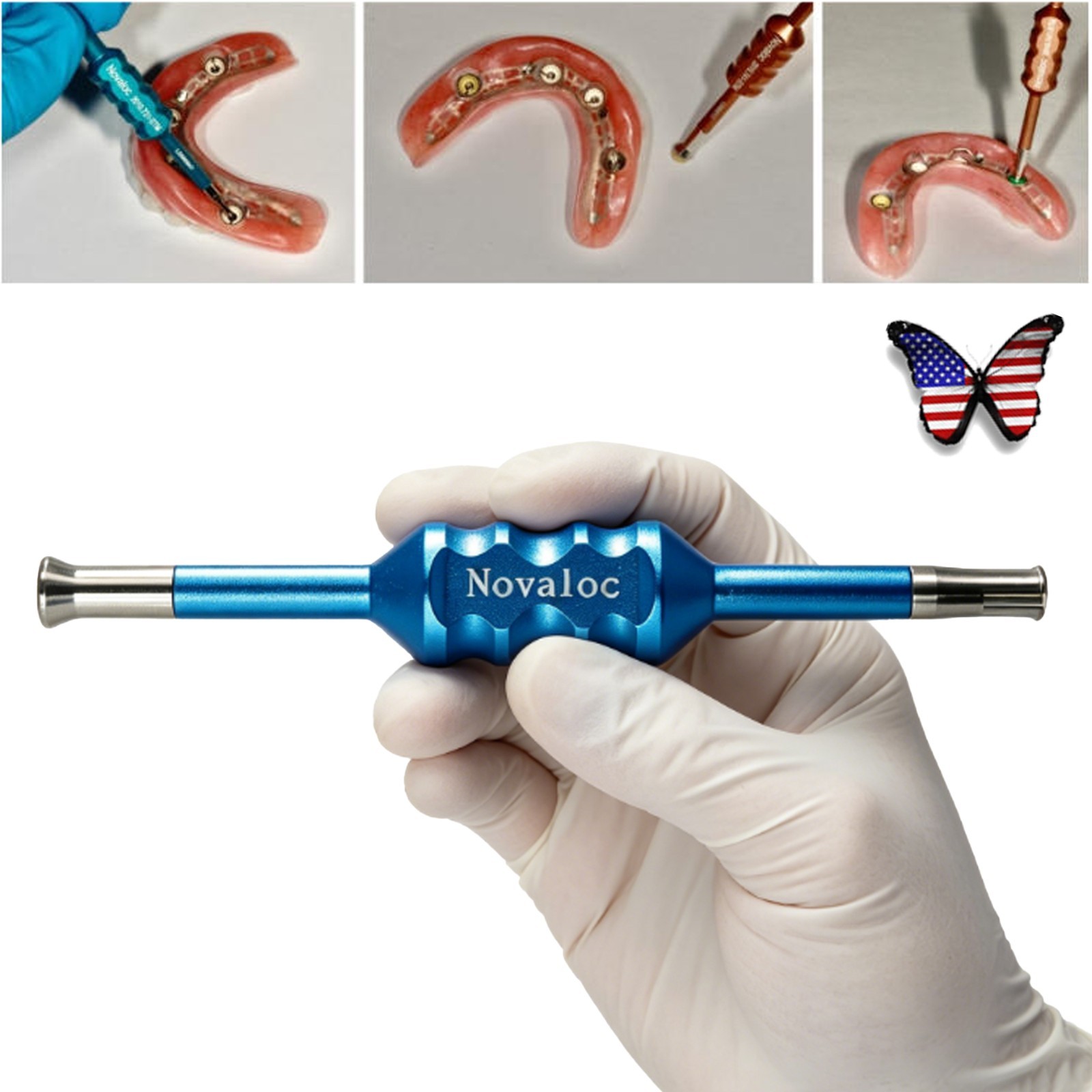 US Dental Ti Novaloc Overdenture Retention Peek Insert Tool & Matrix Housing Kit