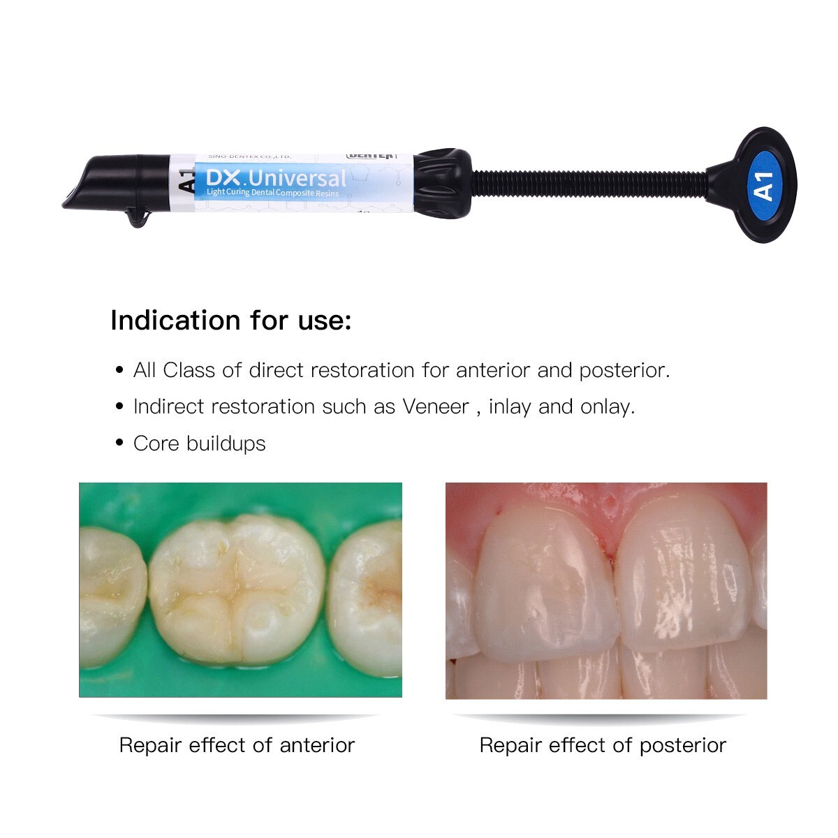 Dental Light Cure Resin Dentin Enamel / Visible Adhesive/ 37% Acid Etching Gel