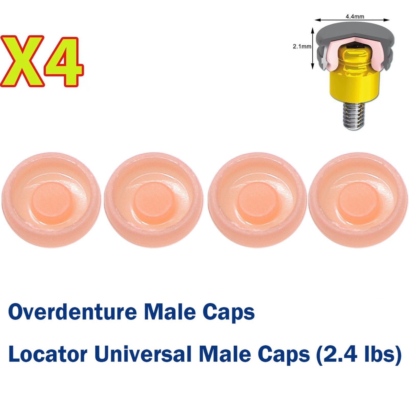 US 4Pcs Dental Overdenture Locator Abutment Strong Retention Cap Implant Inserts