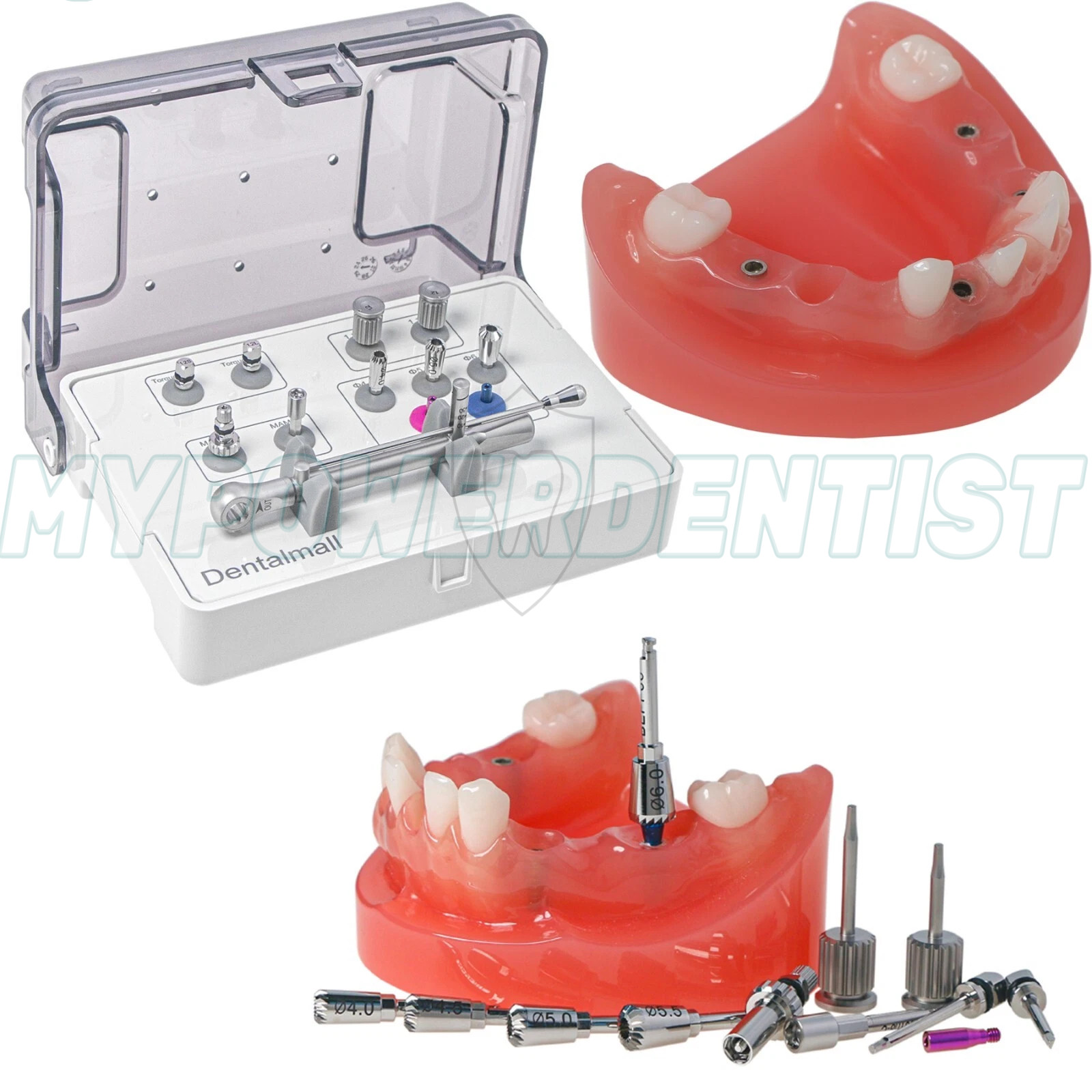 Im-plant Prosthetic Kit Torque Driver Multi ABT Bone Profiler M6019 4.0/5.0/6.0