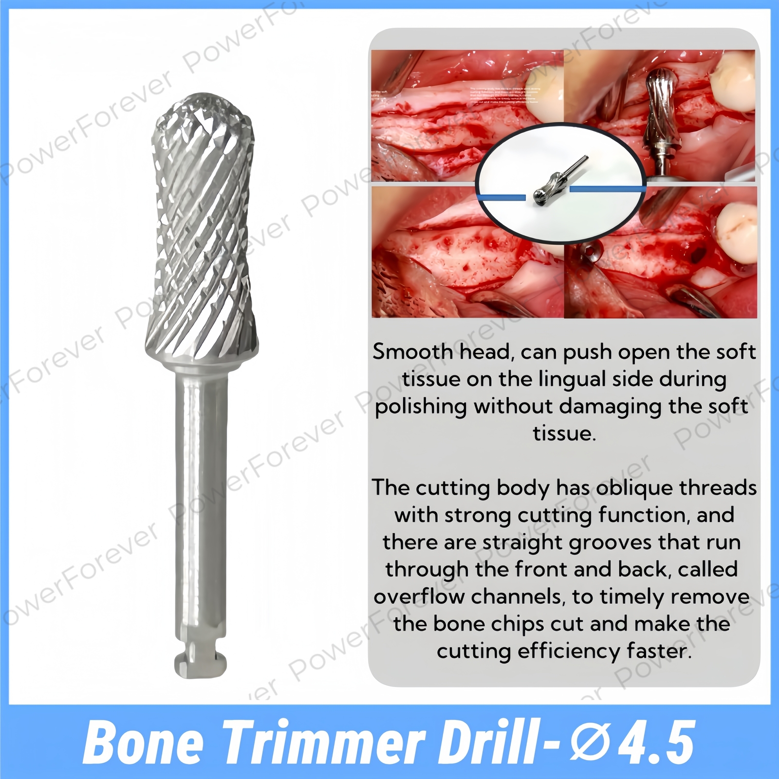 Implant Bone Profiler Dental Bone Mill Kit Sculpting Shaping Alveolar Ridge Tool