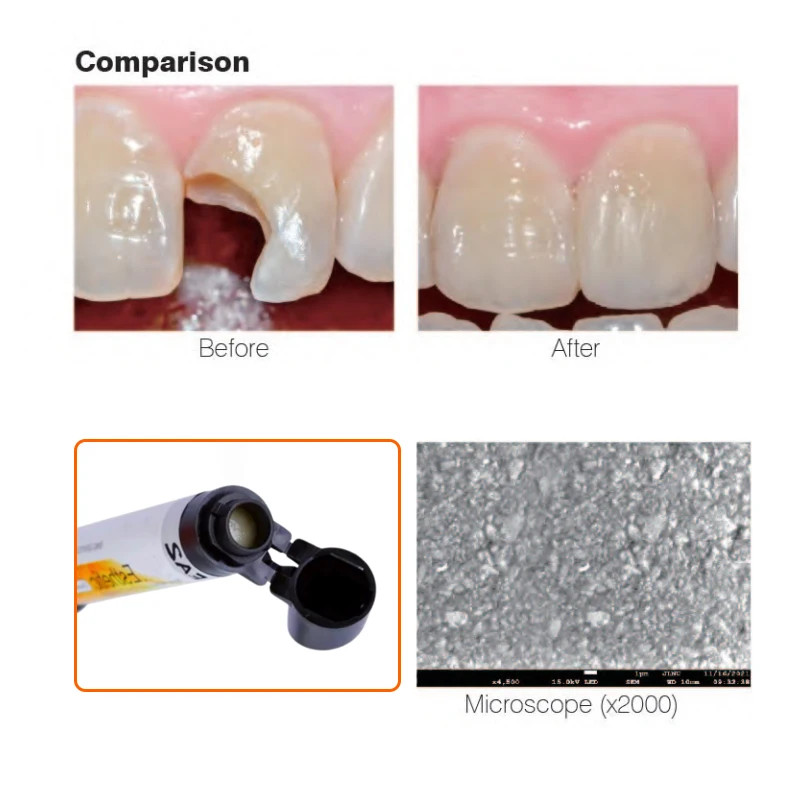 Dental DX.Enamel Nano Hybrid Light Cure Composite Resin Teeth Whitening Kit