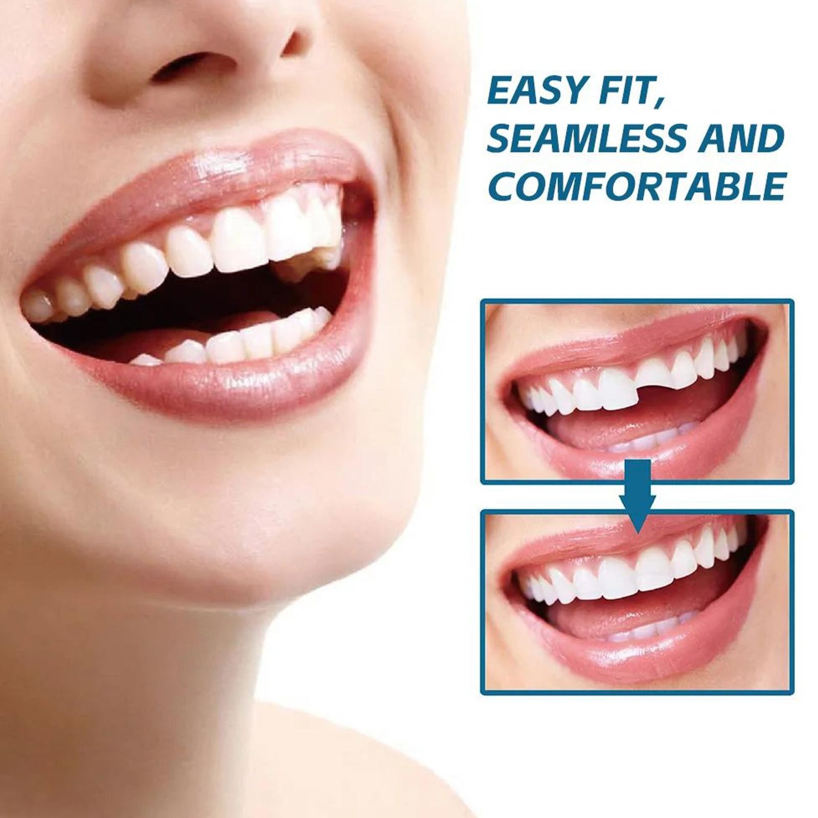 Supplement Syringe Tooth Filler Tooth Repair Resin Teeth Putty Bonding Glue
