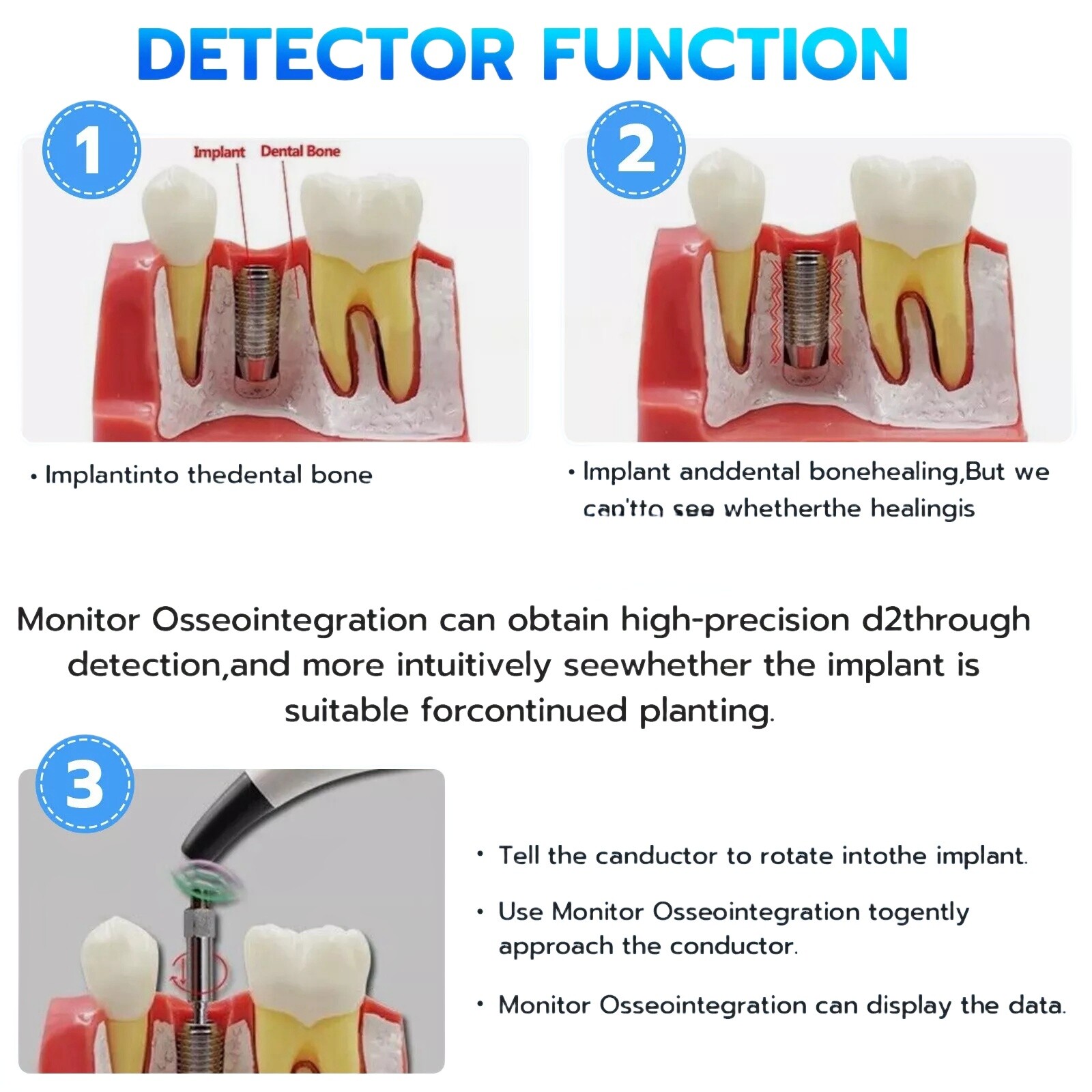 Dental Implant Osseointegration Monitor Stability Measurement Tester Devices ISQ