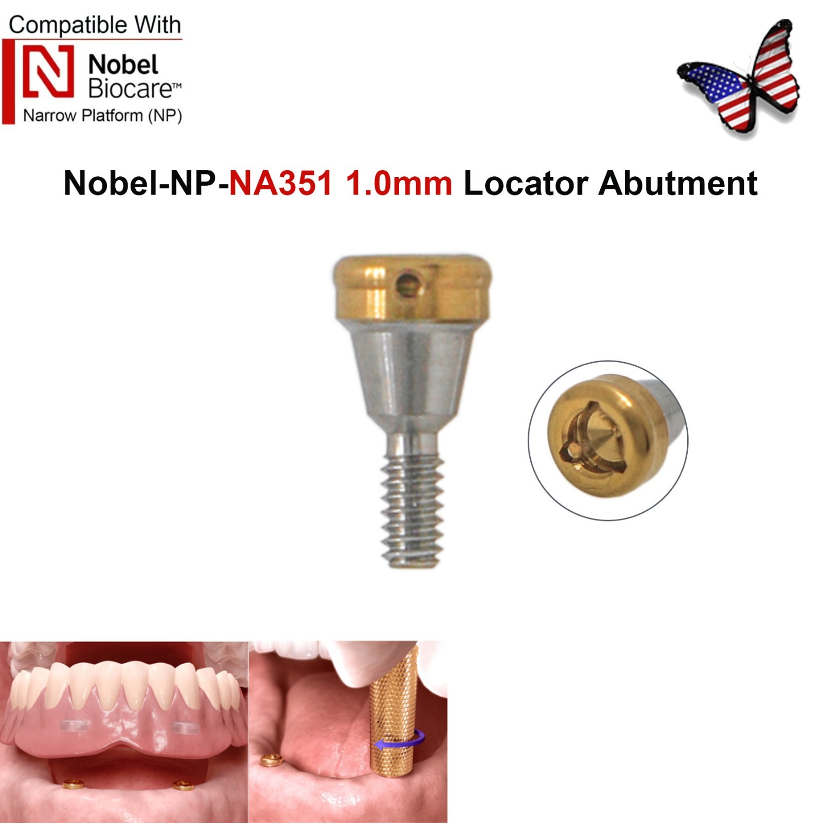 Dental Fit Zest Locator Abutment Legacy Anchor Overdenture Hiossen Zimmer Nobel
