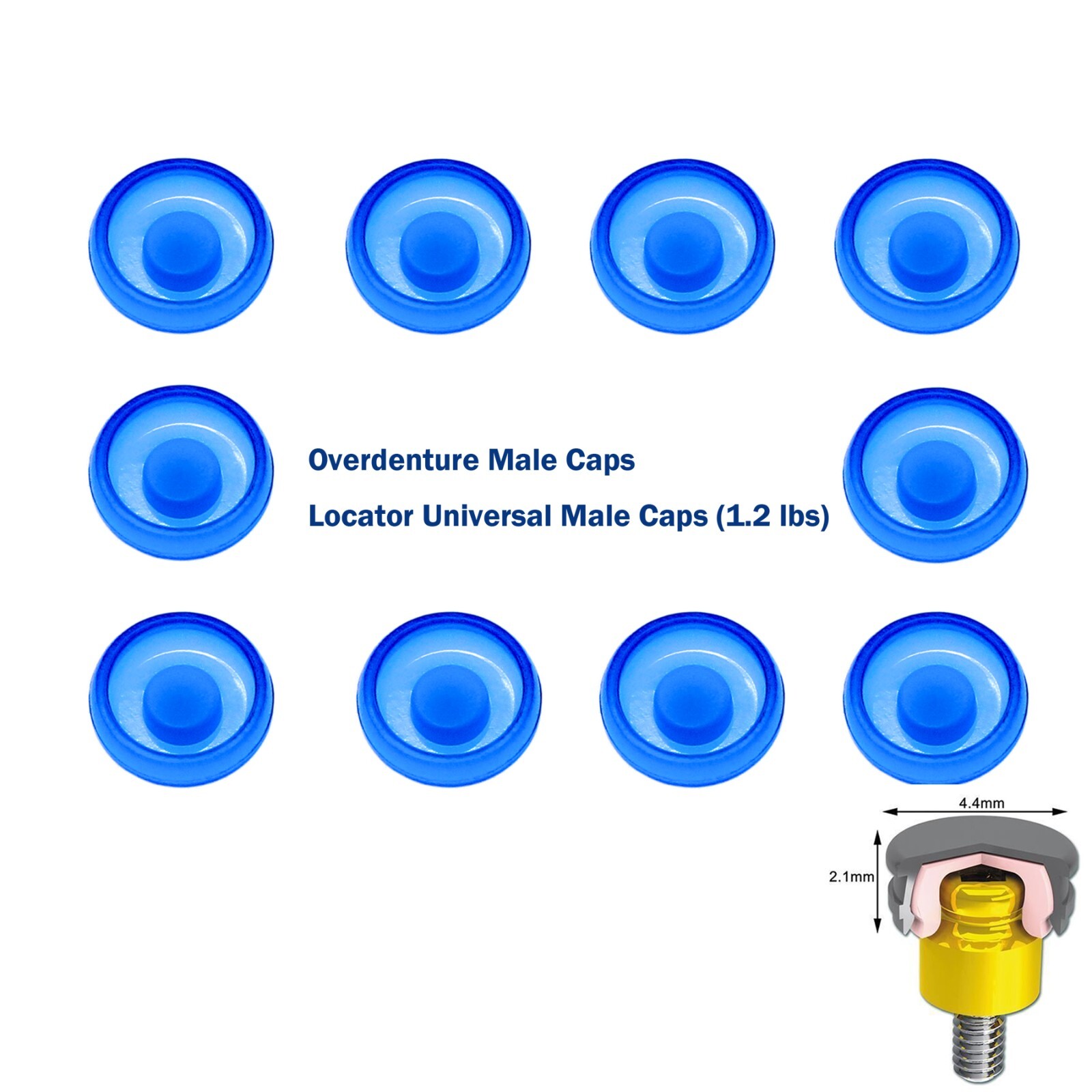 10Pcs Dental Locator Overdenture Abutments Retention Caps For Implant Inserts
