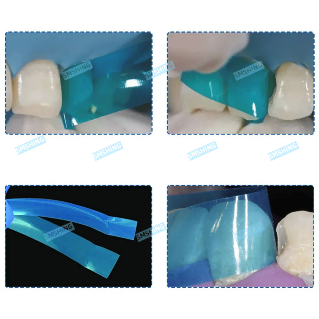 5Box Dental Blue View Matrix Contoured Anterior Matrices Mylar Anatomical Strip
