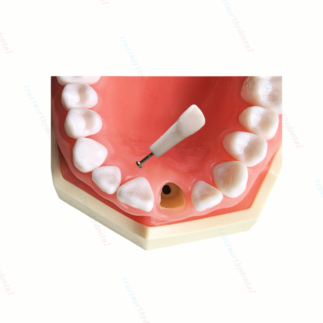Dental Typodont Model with Removable Teeth M8011 DP 32 Demonstration Teach Study