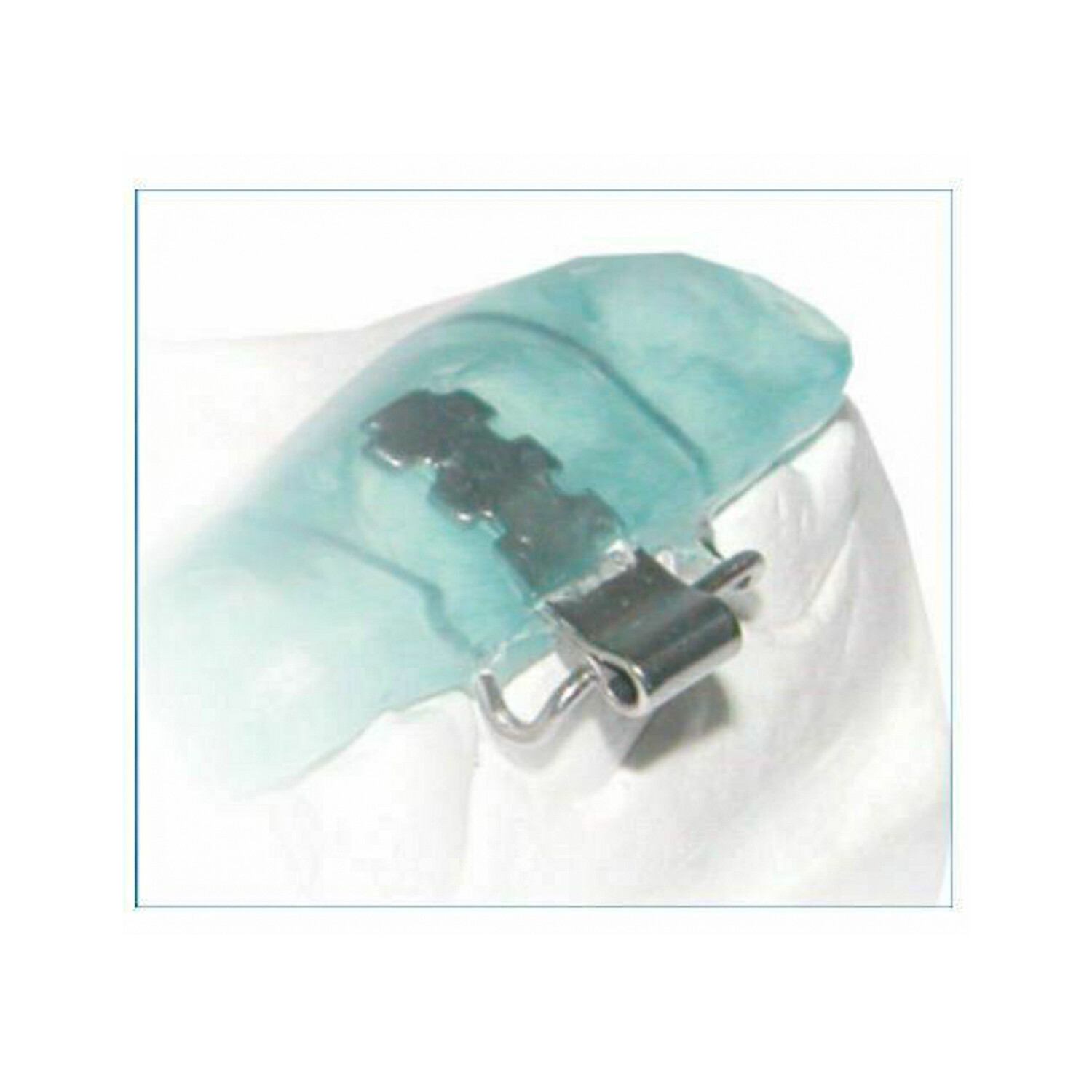 Dental Dentaurum Orthodontic Tube Activator With Bar For Treatment Class II