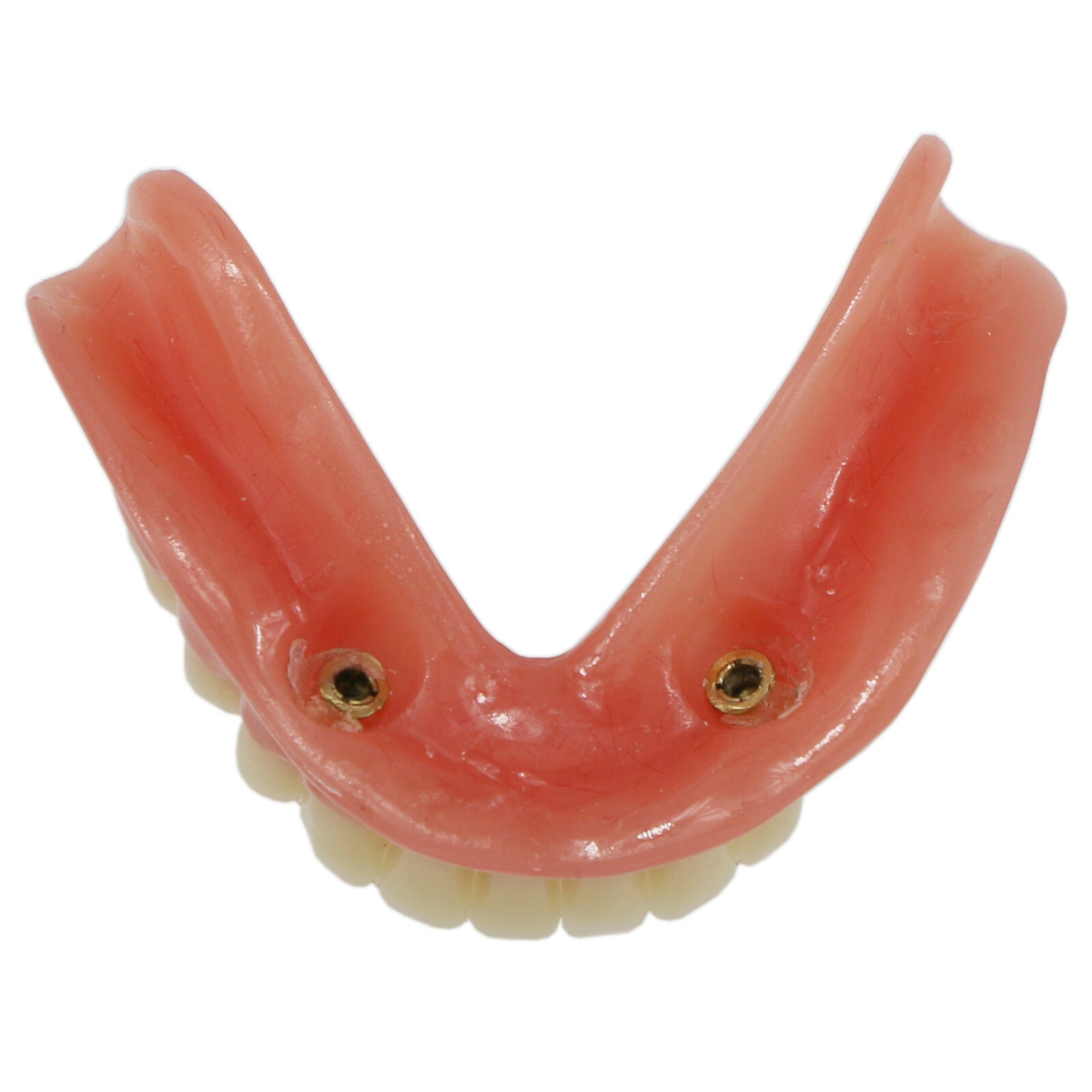 Dental Typodont Teeth Model Overdenture Lower Inferior 2 Implants Demo M-6002 US