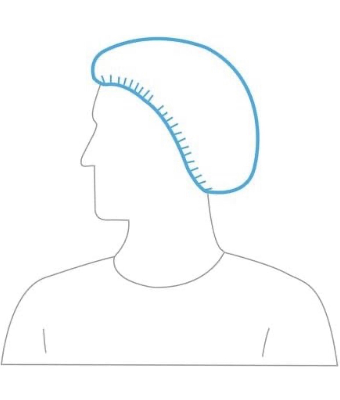 Bouffant Caps – 21″ Universal White BOX OF 1000