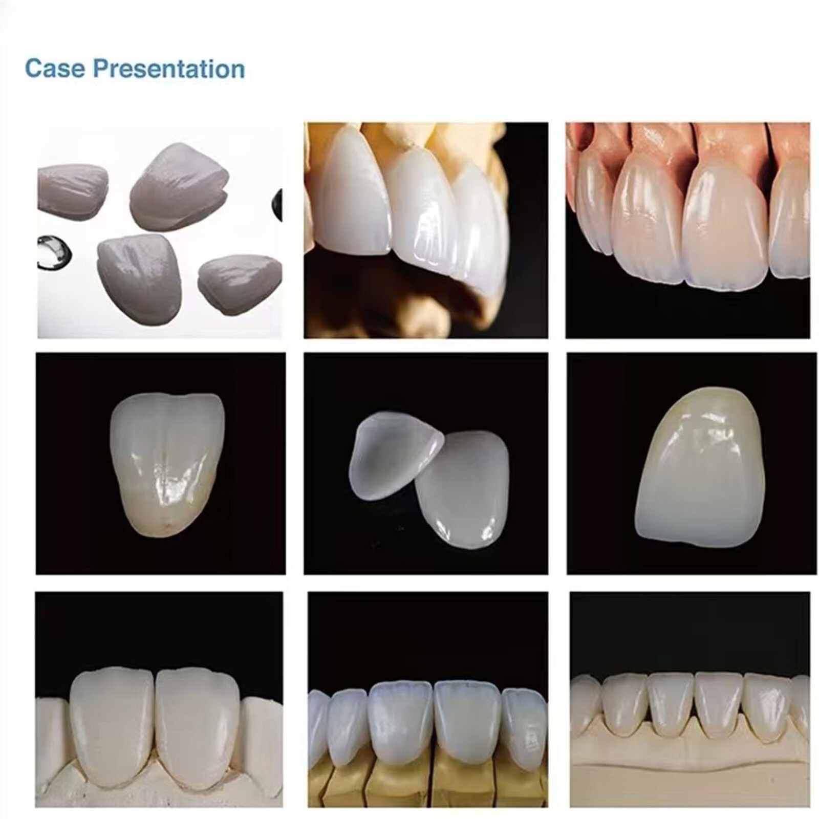 US 5PCS C14 Emax Dental Glass Ceramic Lithium Dislicate CAD/CAM Cerec Blocks B2