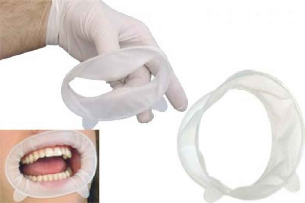 6 x Ivoclar OPTRAGATE 3D Mouth Opener Dental Cheek & Lip Retractor SMALL/REGULAR
