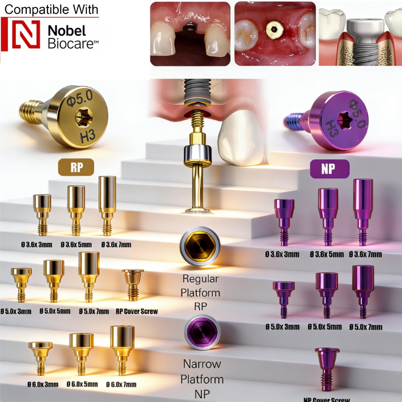 US 5Pc Dental Healing Abutment NP/RP Fit Nobel Biocare Internal Conical Titanium